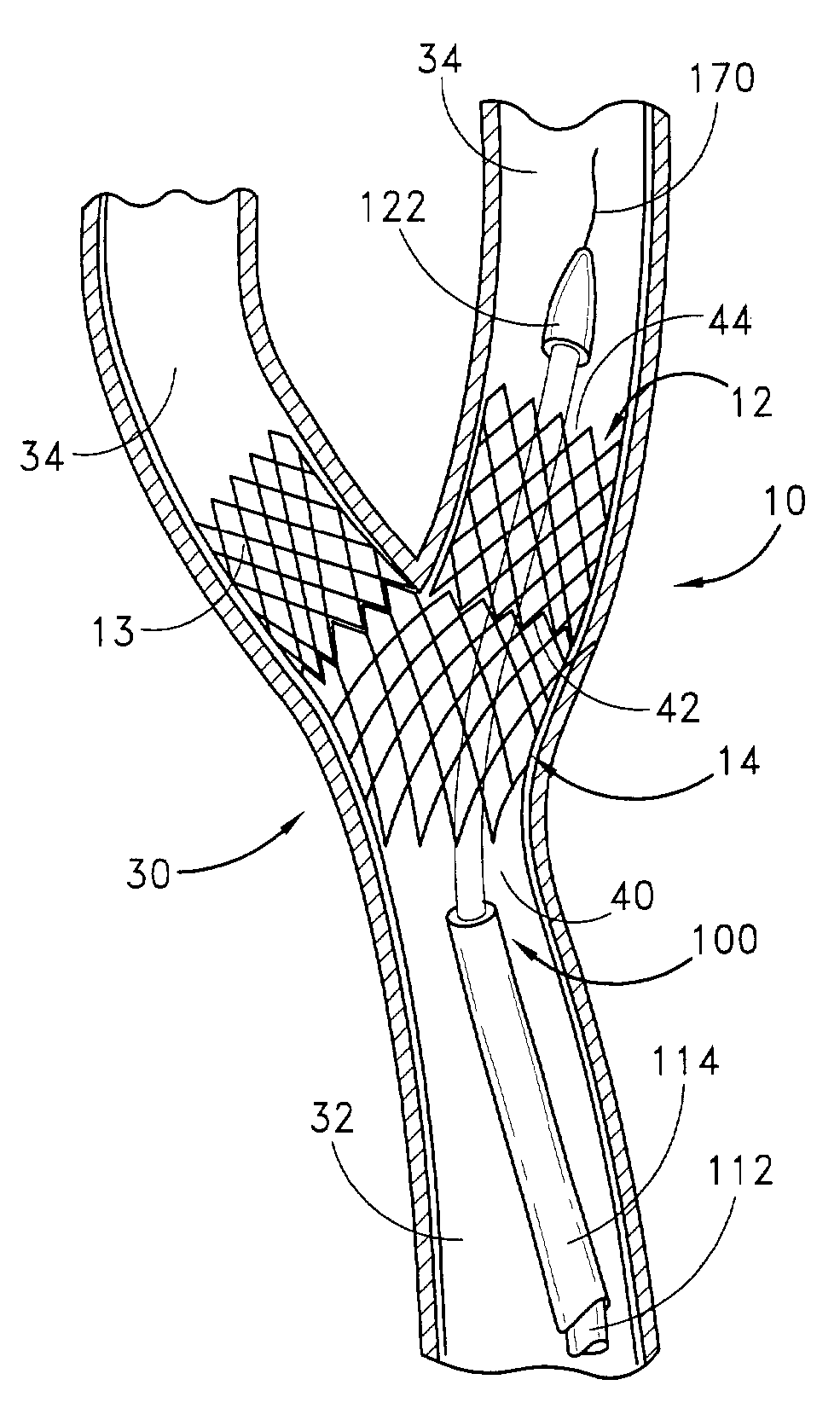 Noncylindrical drug eluting stent for treating vascular bifurcations