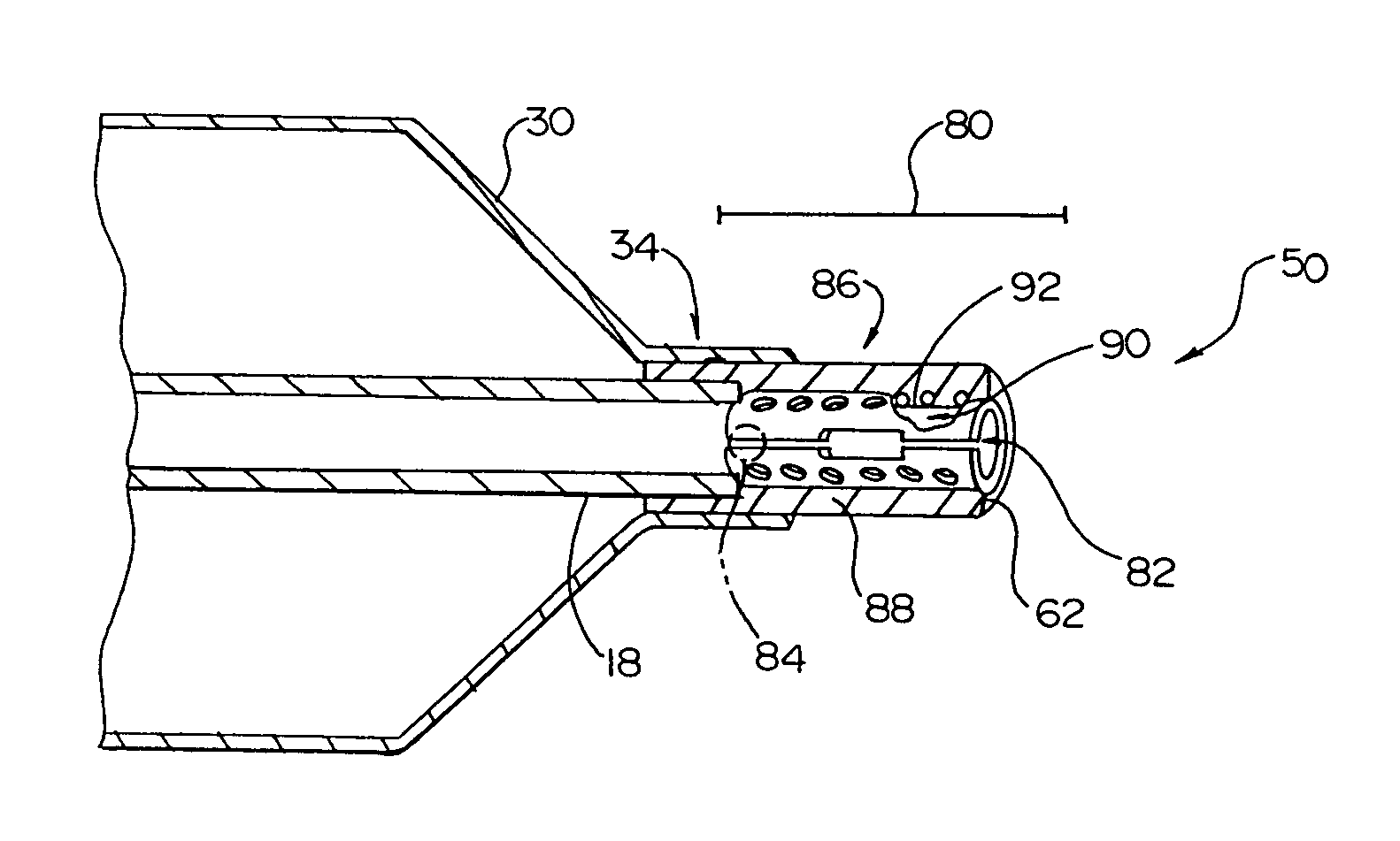 Catheter incorporating a high column strength distal tip region