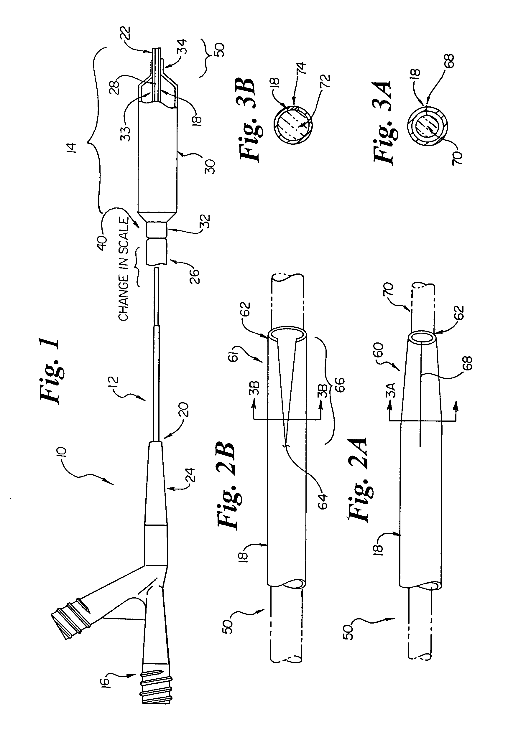 Catheter incorporating a high column strength distal tip region