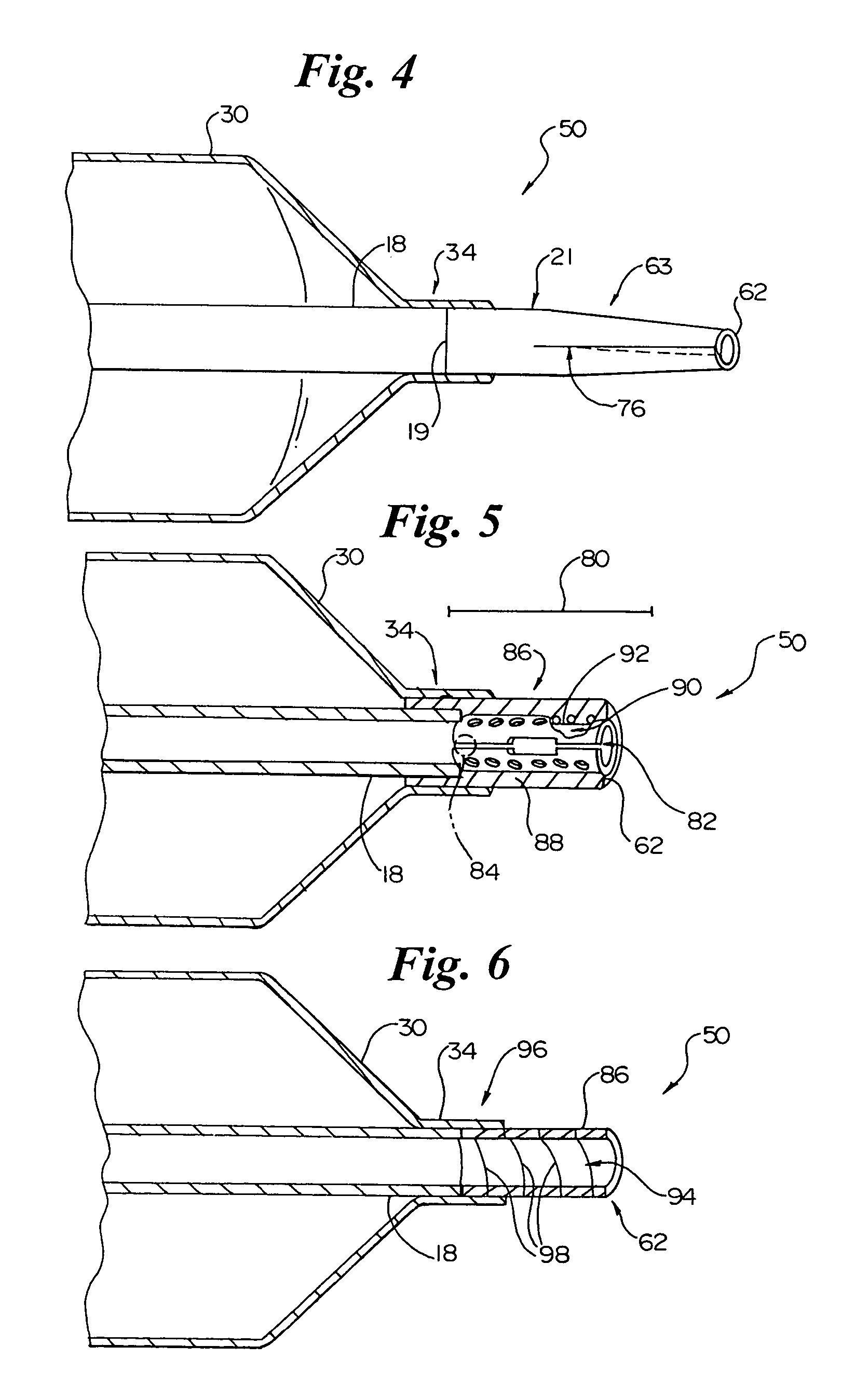 Catheter incorporating a high column strength distal tip region