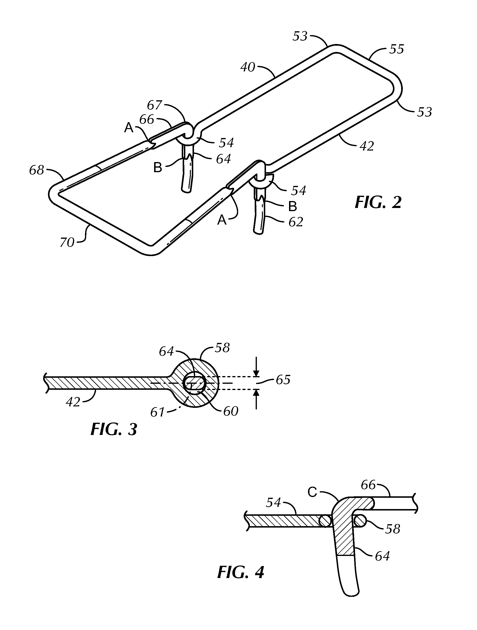 High-strength partially compressed veneer ties and anchoring systems utilizing the same