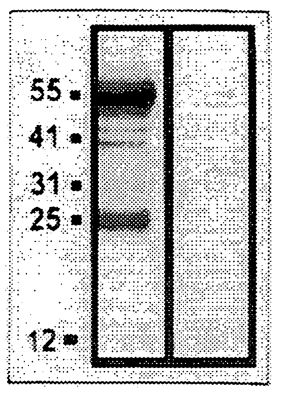 Diagnostic markers of human female infertility