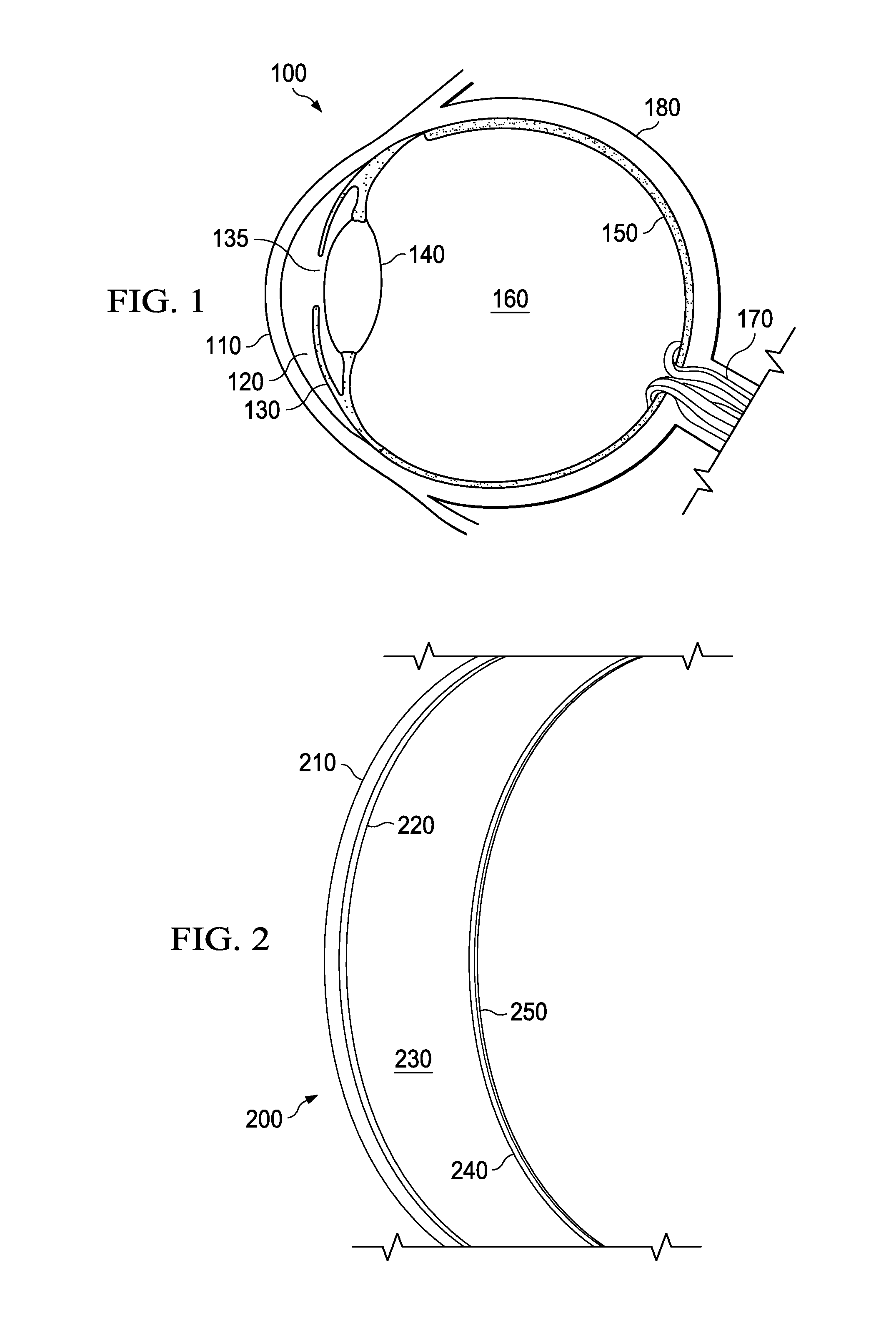 Mazaheri LASIK method for visual enhancement