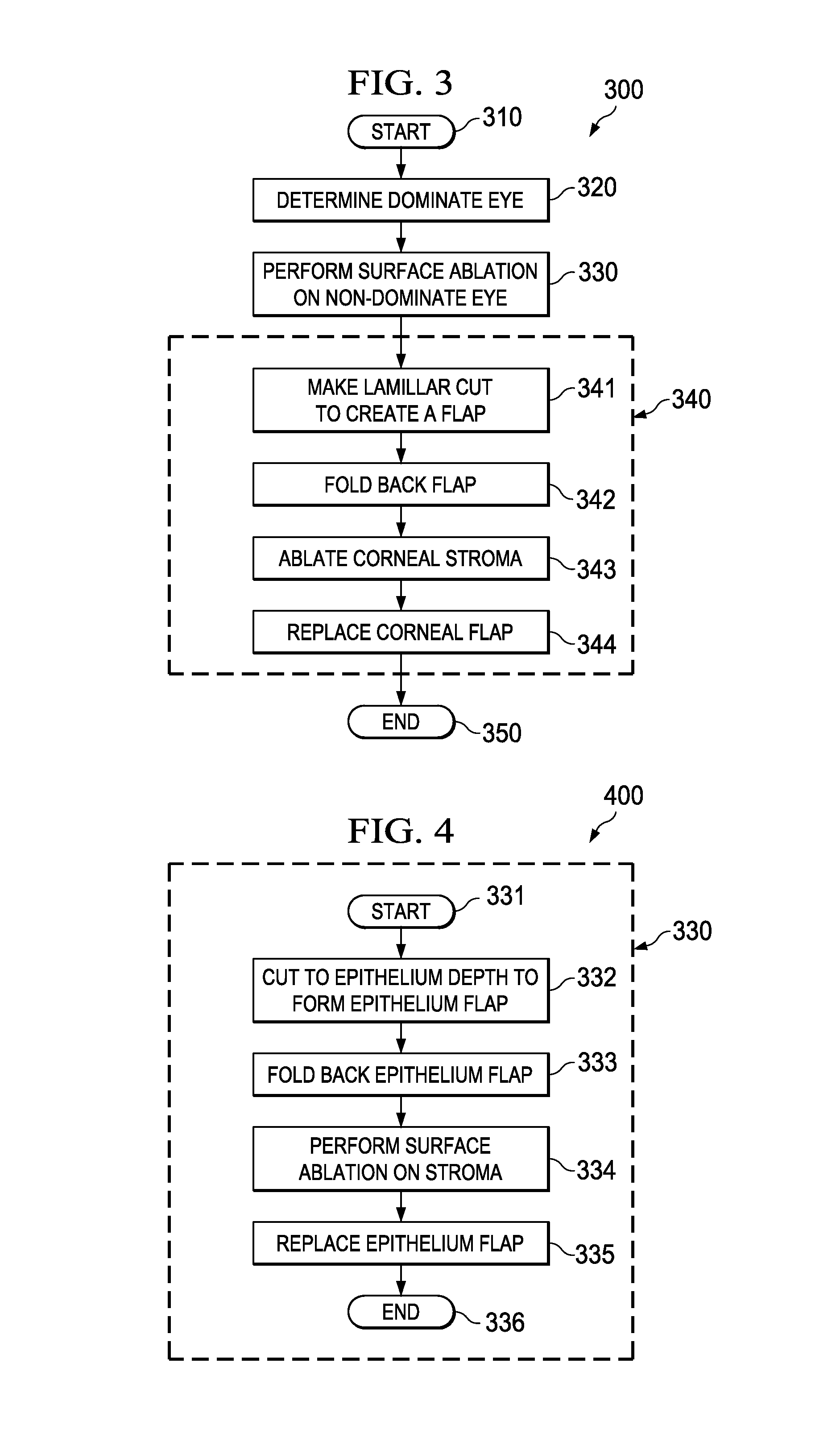 Mazaheri LASIK method for visual enhancement