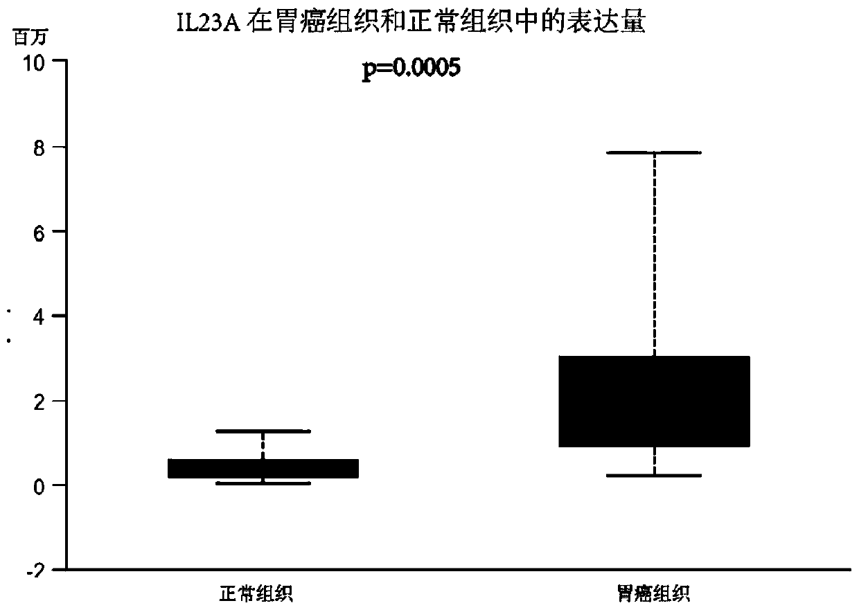 Biomarker for gastric cancer diagnosis and prognosis evaluation, application of biomarker and detection kit