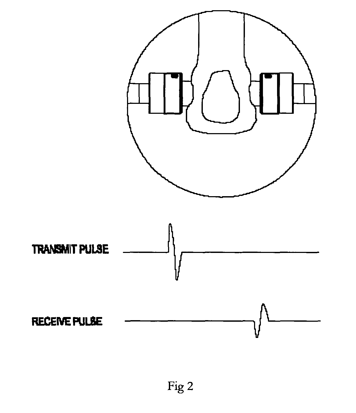 Bone densitometer and a method thereof