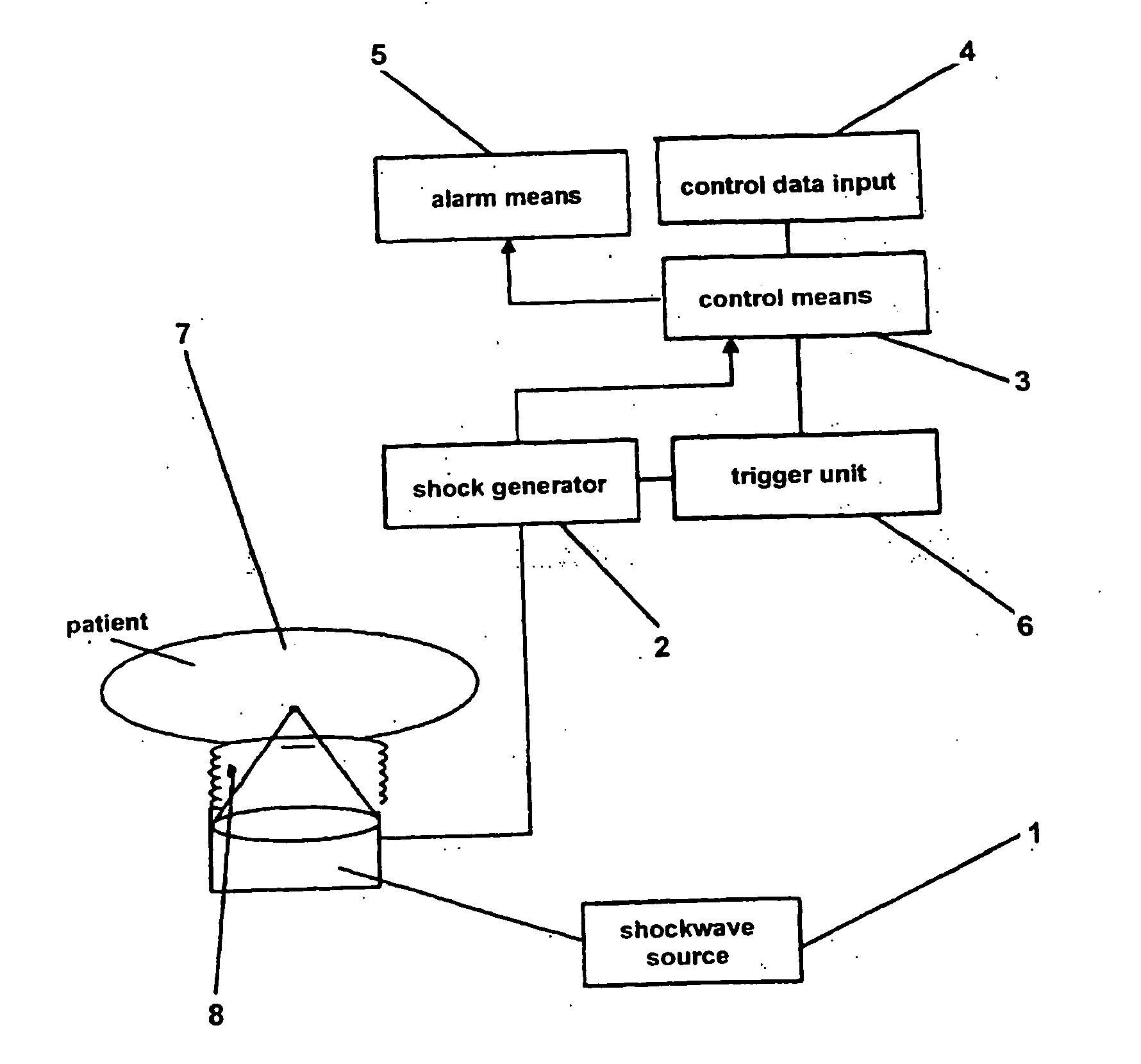 Shockwave or pressure-wave type therapeutic apparatus