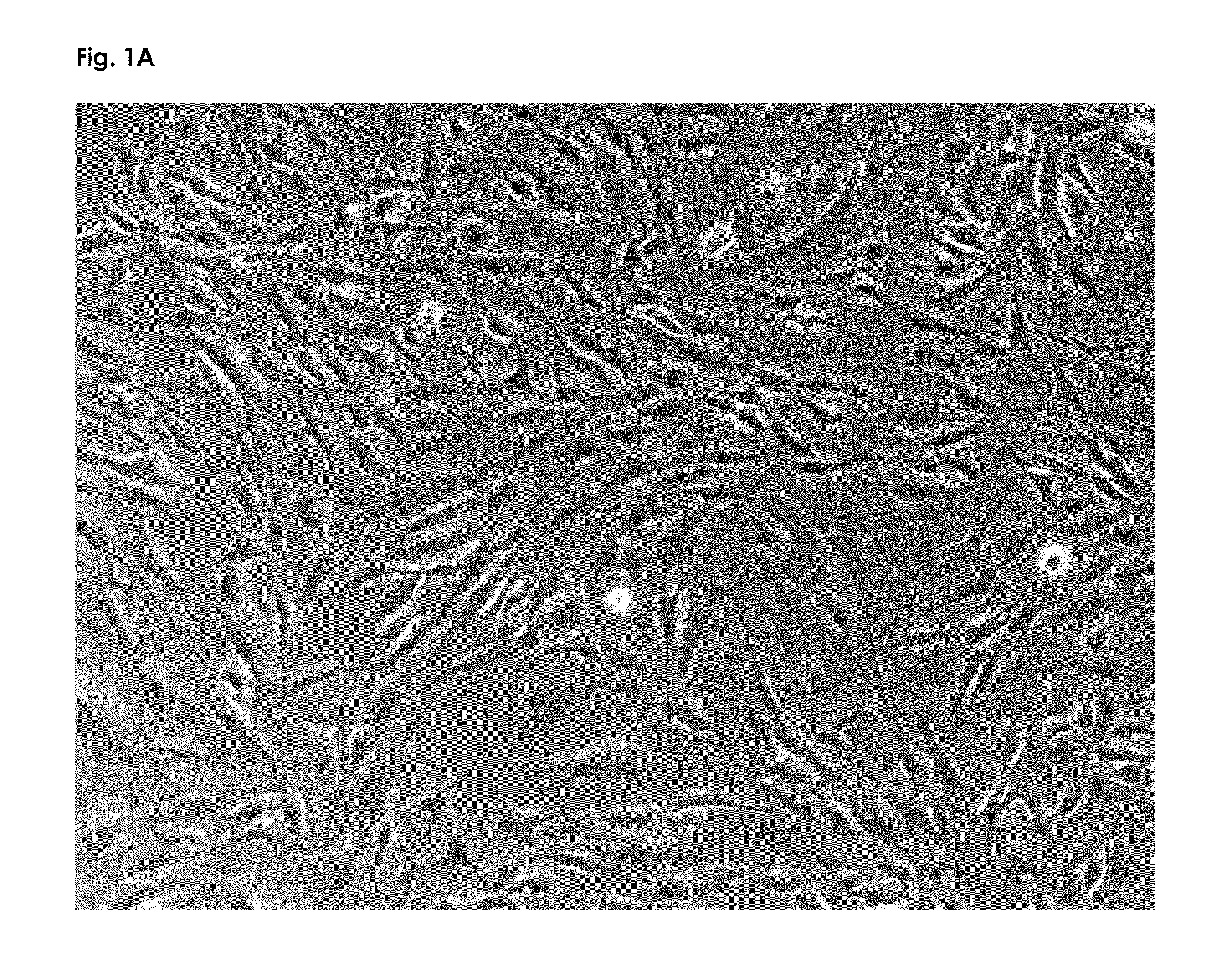 Nutritional composition containing a neurologic component of kaempferol and/or fisetin and uses thereof