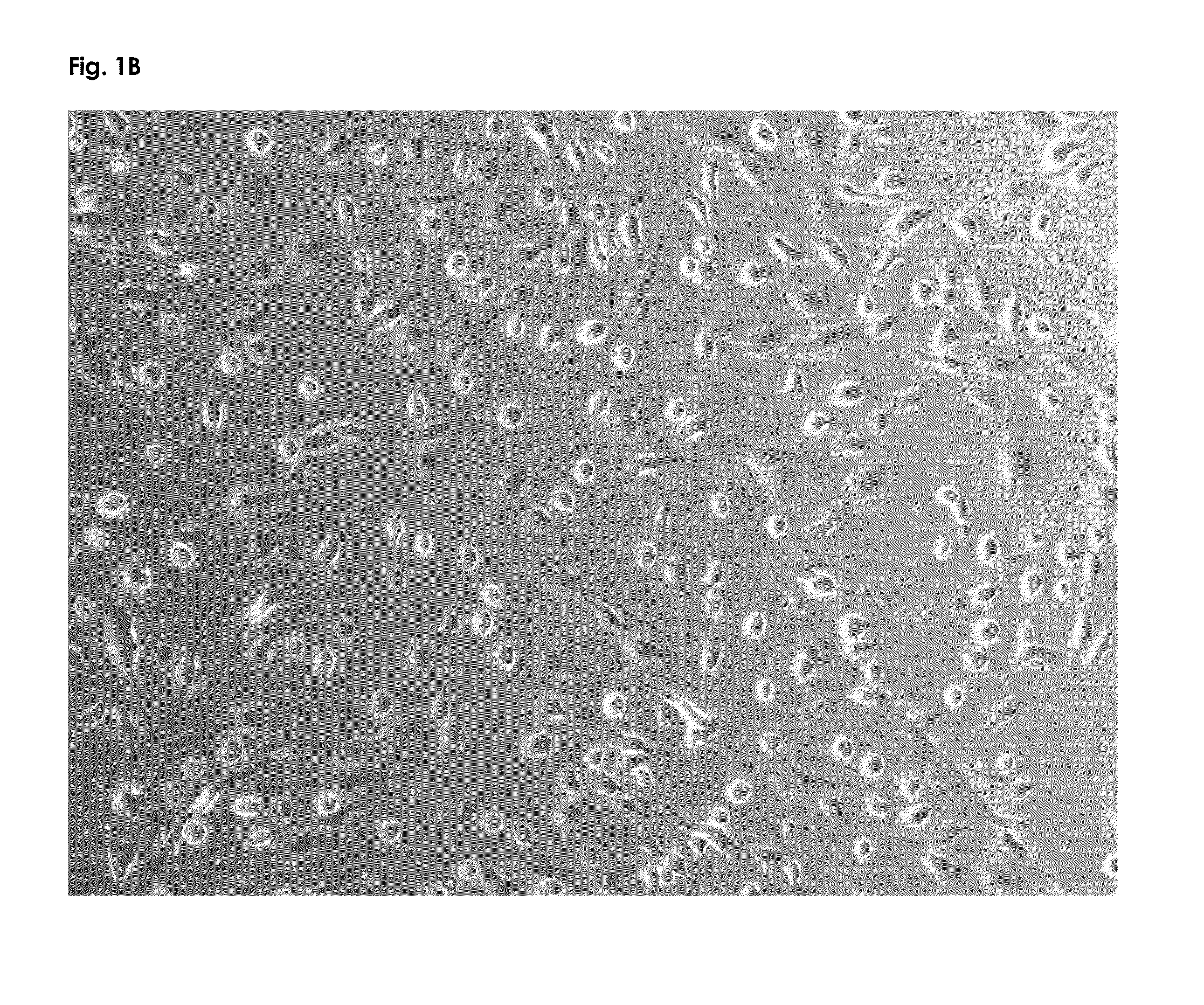 Nutritional composition containing a neurologic component of kaempferol and/or fisetin and uses thereof