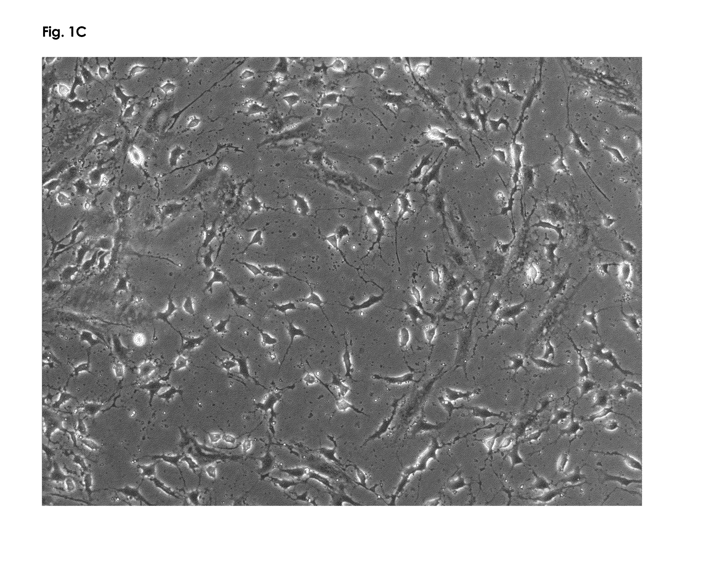 Nutritional composition containing a neurologic component of kaempferol and/or fisetin and uses thereof