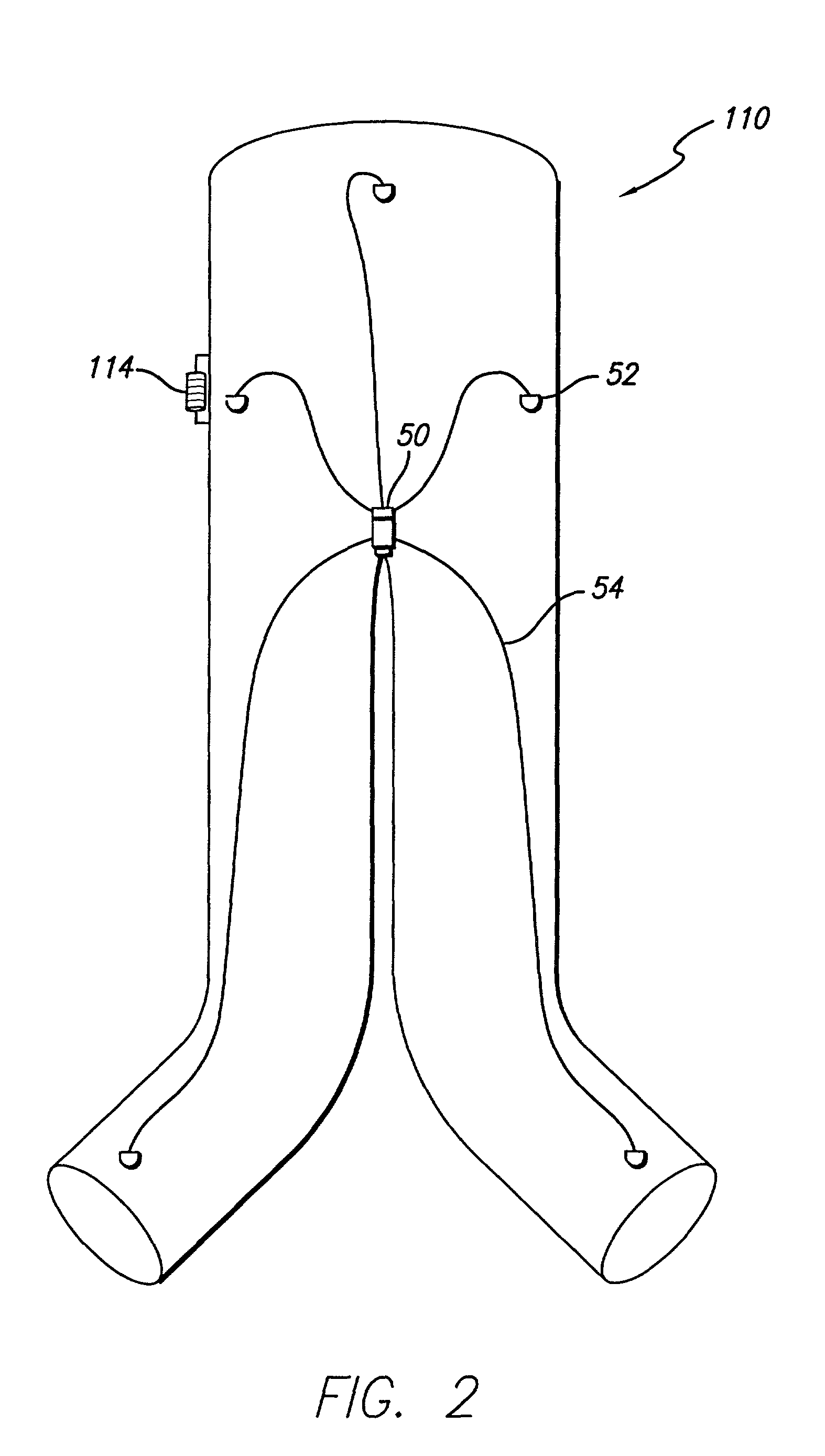 Endovascular graft with sensors design and attachment methods