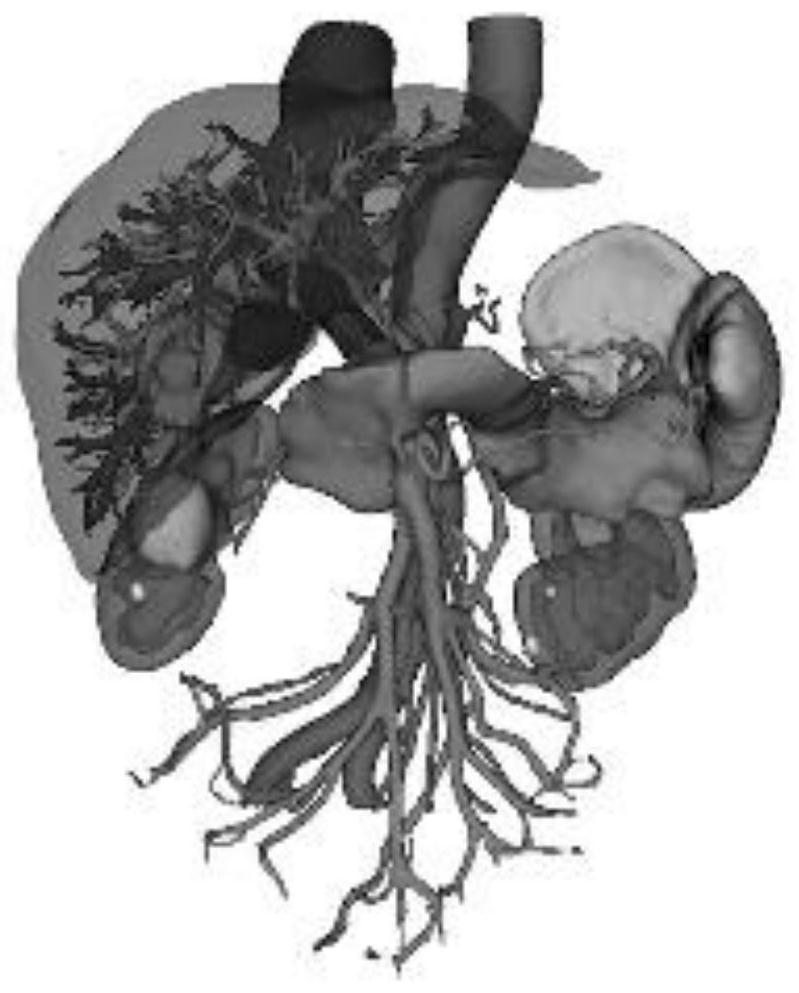 Liver segmentation system based on drainage basin analysis and operation method thereof