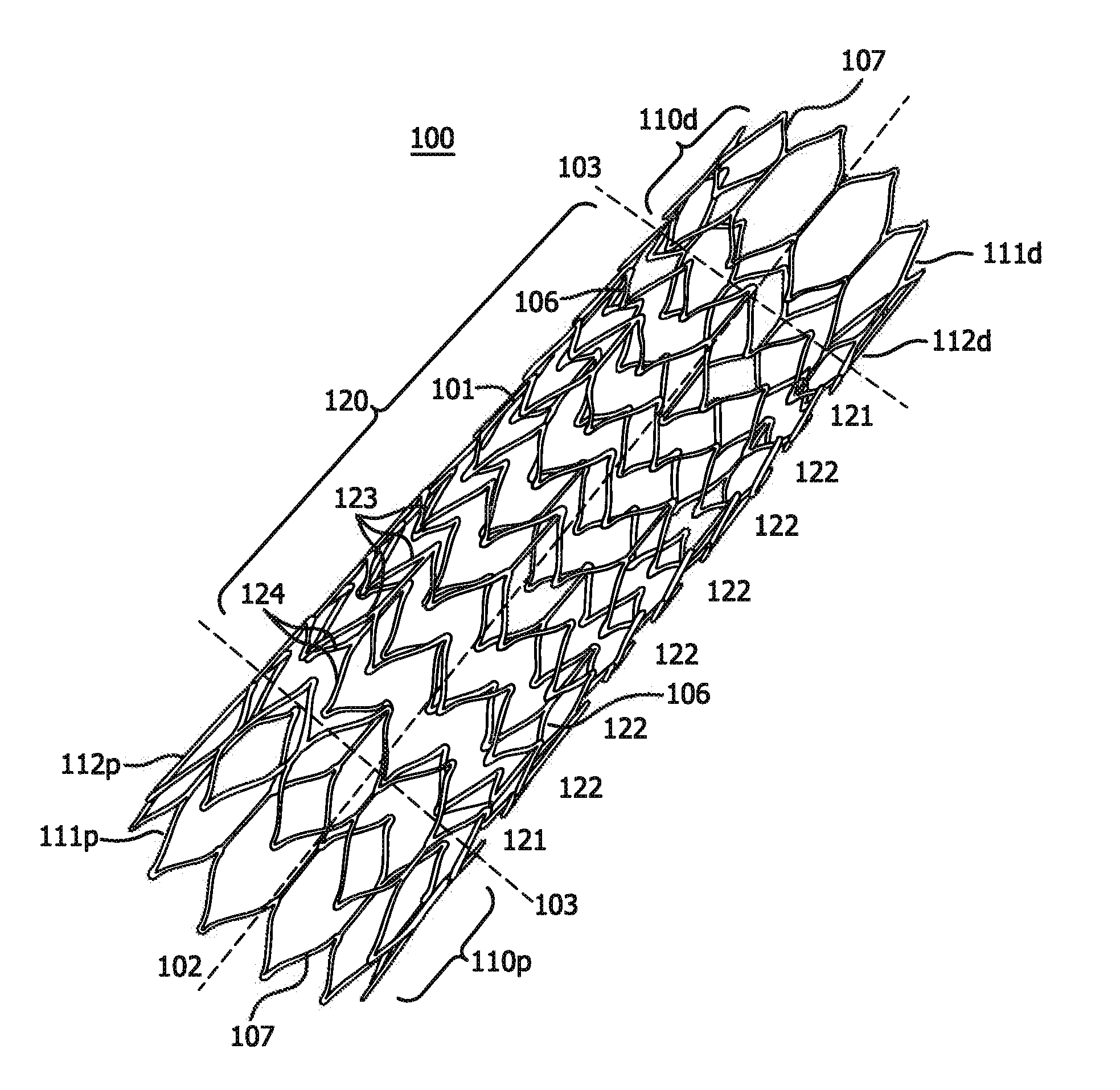 Stent