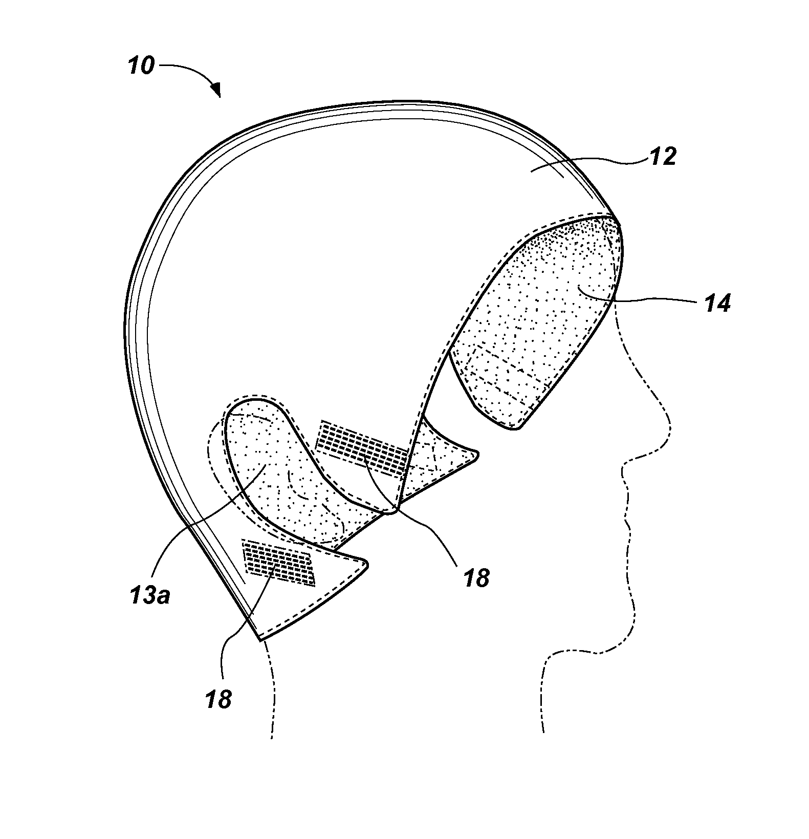 Head trauma bandage cap and method