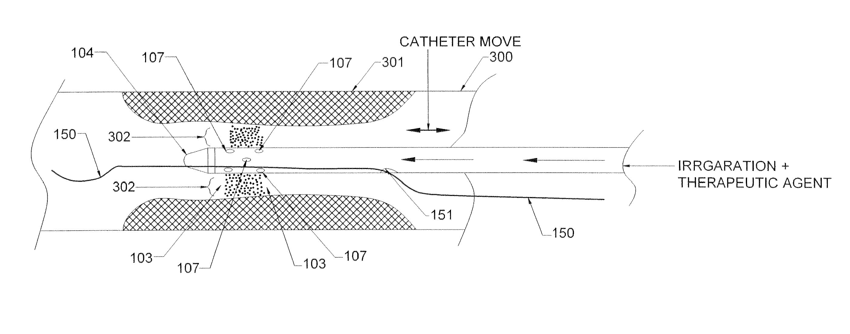 Methods and devices for endovascular therapy