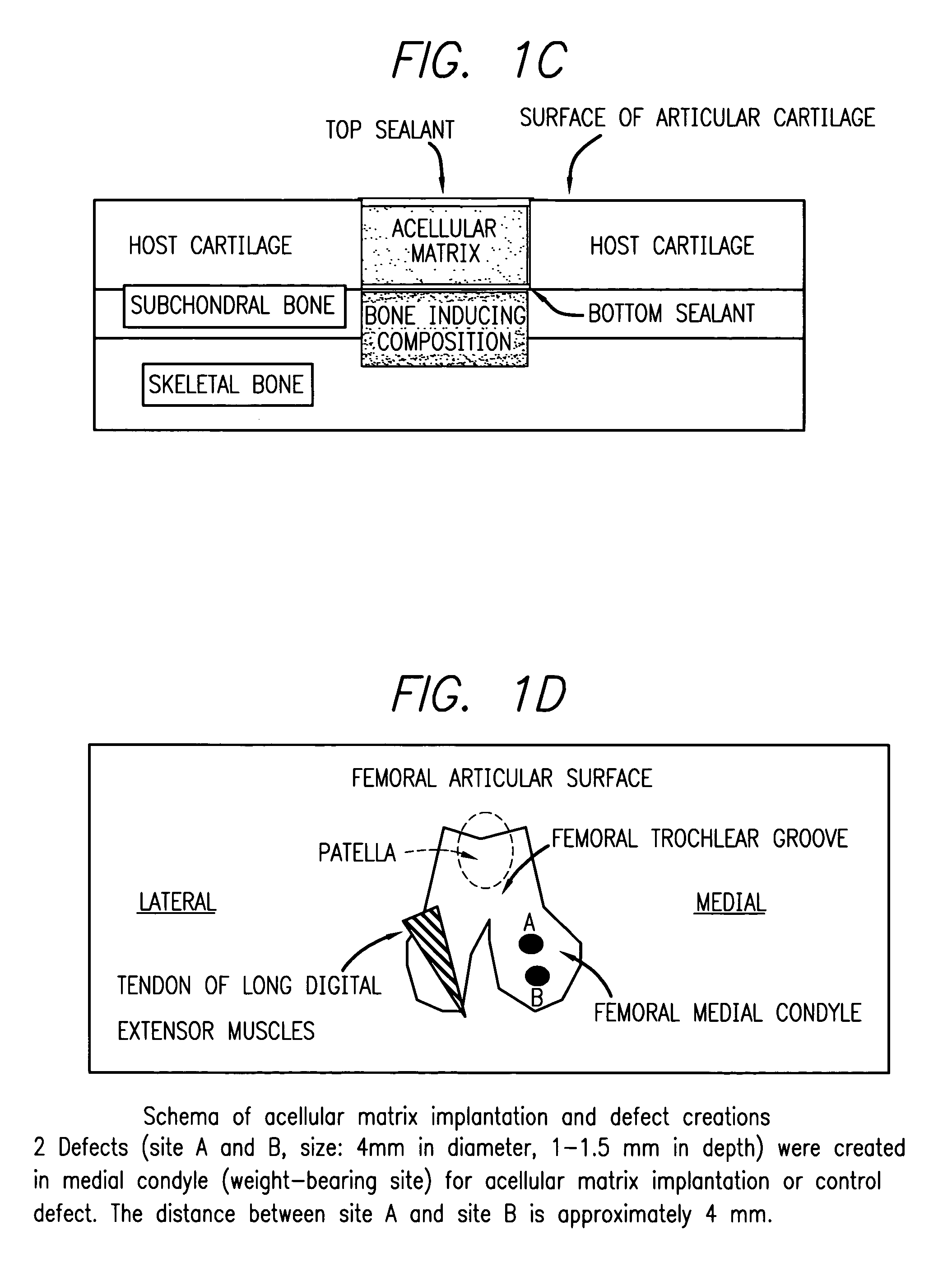 Method for treatment of osteochondral and bone defects using an acellular matrix implant