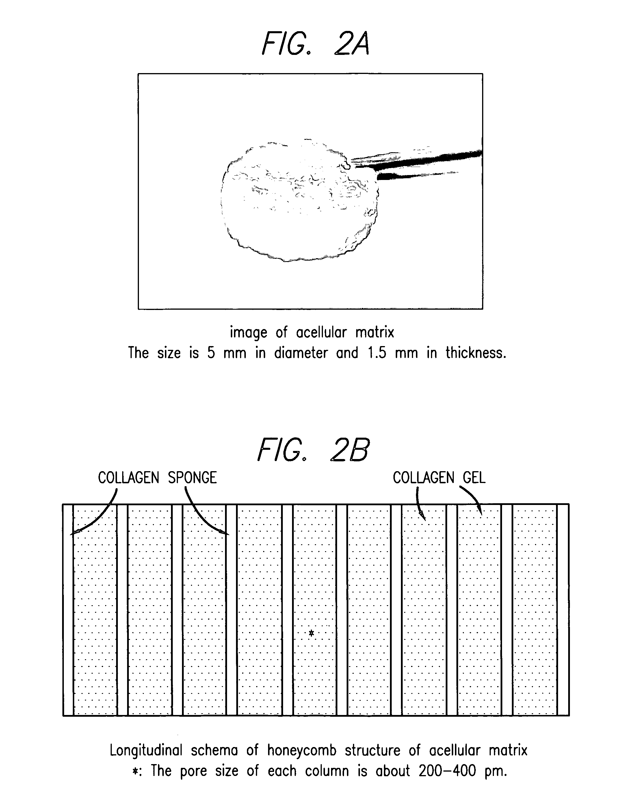 Method for treatment of osteochondral and bone defects using an acellular matrix implant