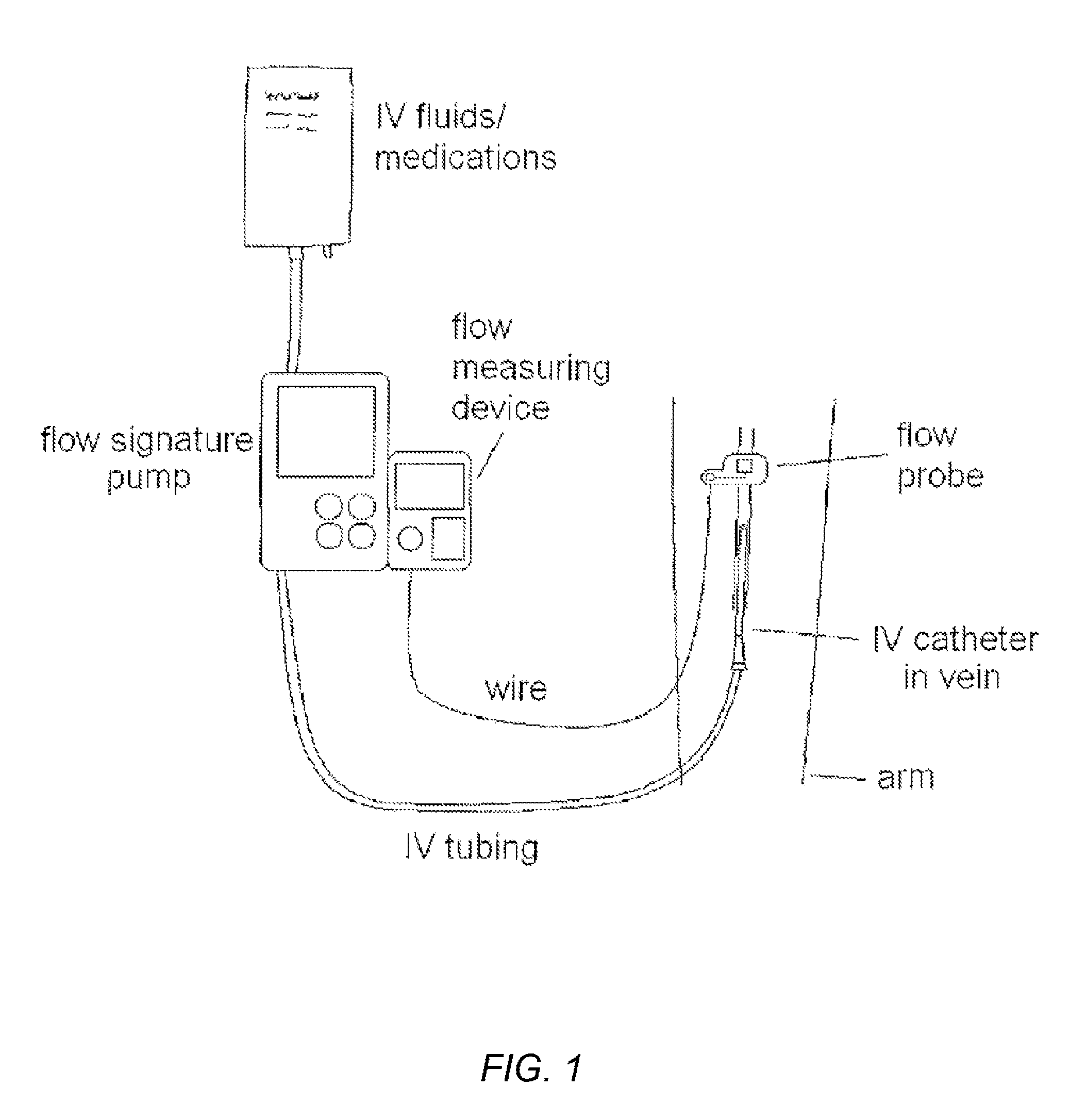 System of intravenous fluid/medication delivery that employs signature flow amplitudes or frequencies to facilitate the detection of intravenous infiltration