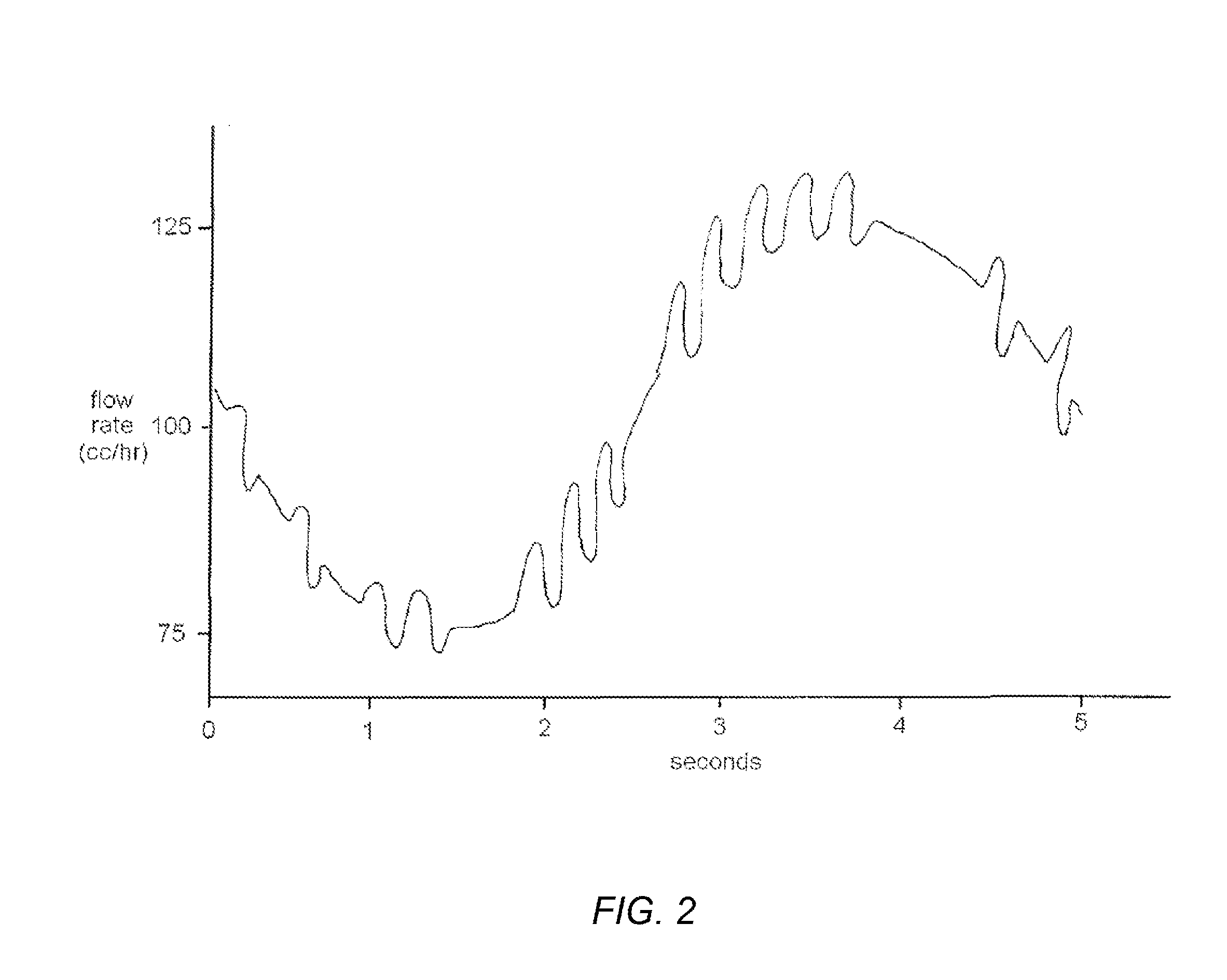 System of intravenous fluid/medication delivery that employs signature flow amplitudes or frequencies to facilitate the detection of intravenous infiltration