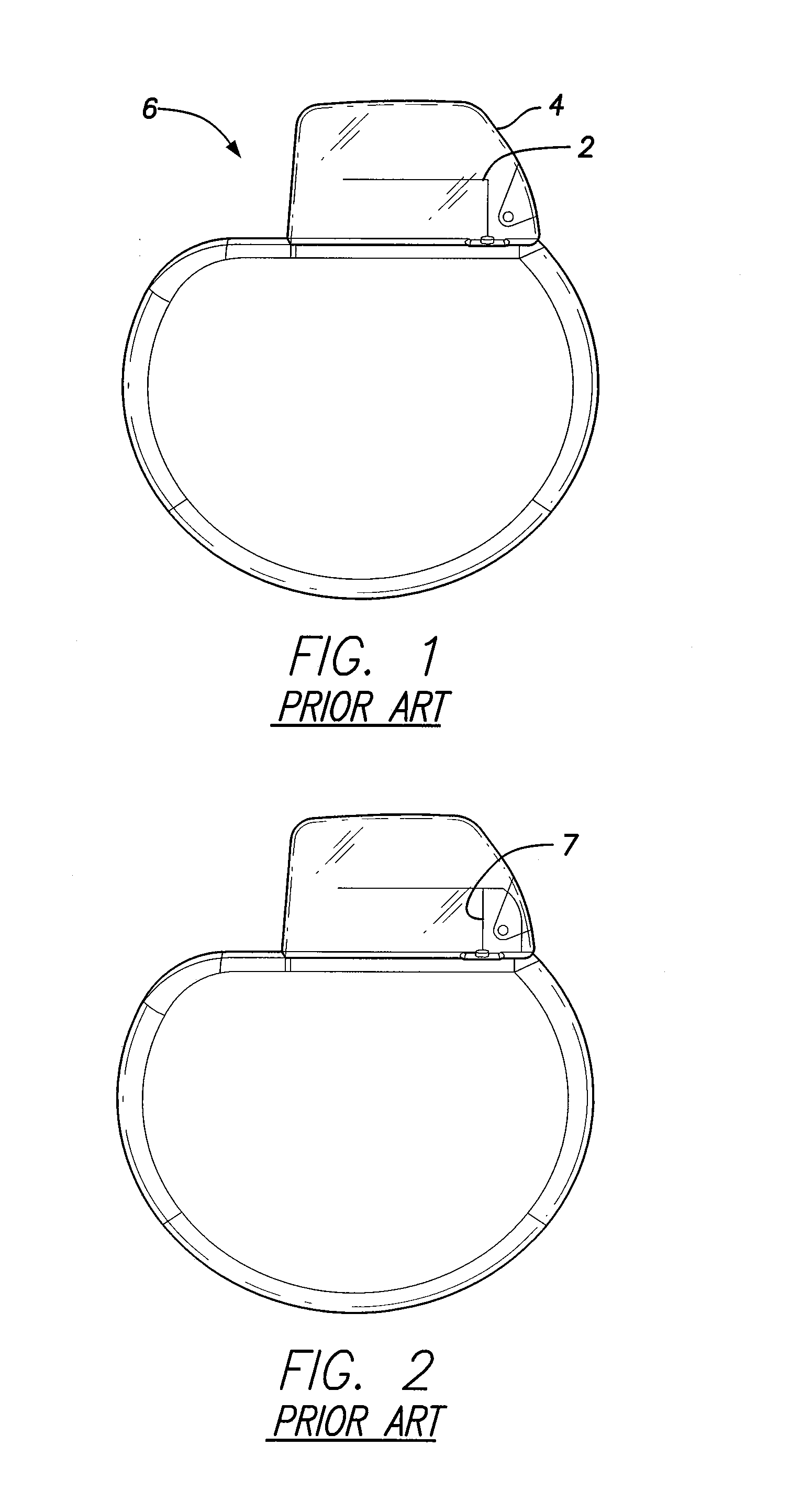 Inverted e antenna with parallel plate capacitor formed along an arm of the antenna for use with an implantable medical device