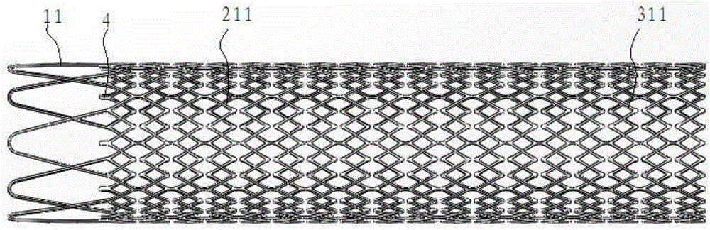 Intravascular stent and preparation method and application thereof