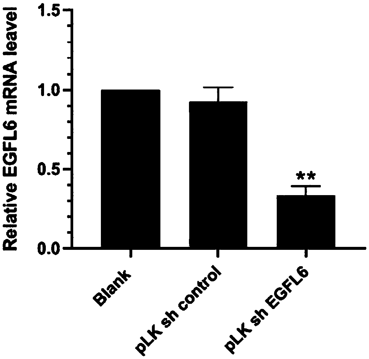 SiRNA (small interference Ribonucleic Acid) for targeted inhibition on expression of esophagus cancer EGFL6 gene, constructed expression vector and application