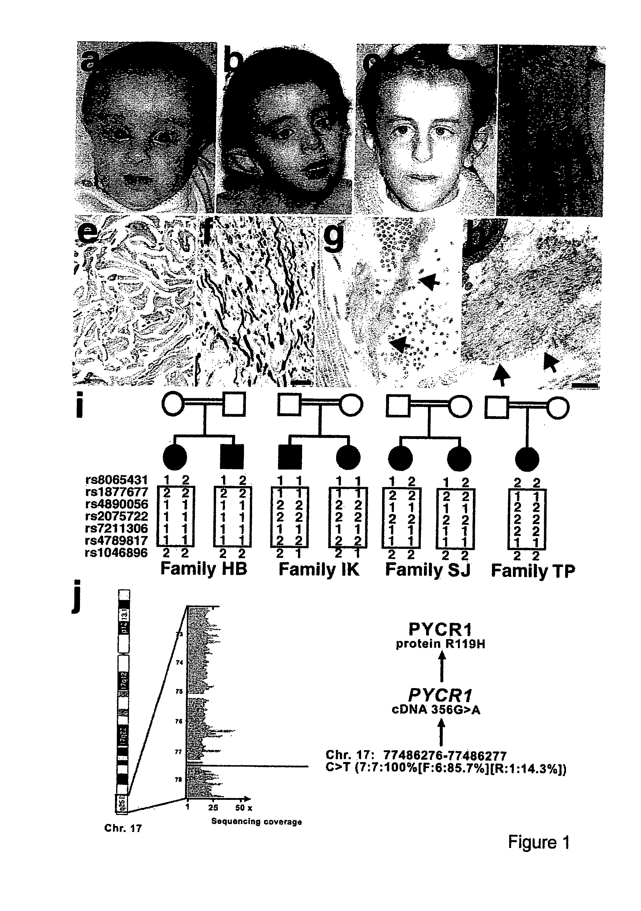 Muteins of the pyrroline-5-carboxylate reductase 1