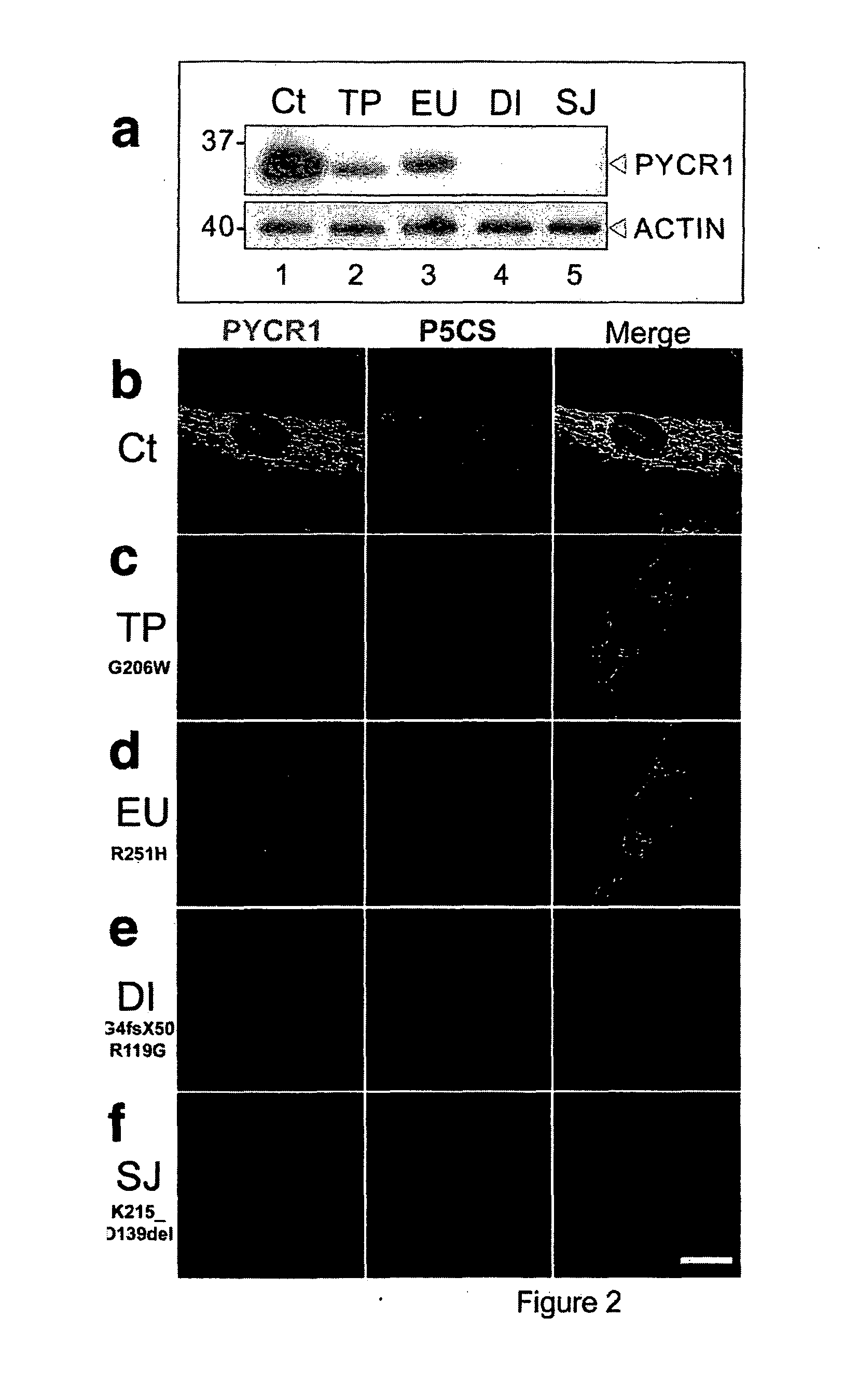 Muteins of the pyrroline-5-carboxylate reductase 1