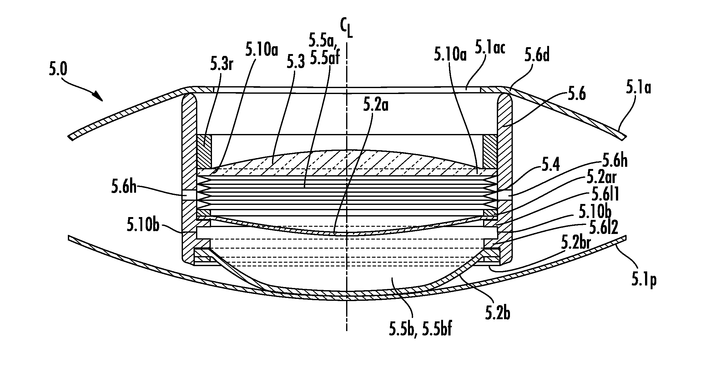 Anterior-Posterior-Capsule-Actuated Hydraulic Accommodative Intraocular Lenses and Lens Systems