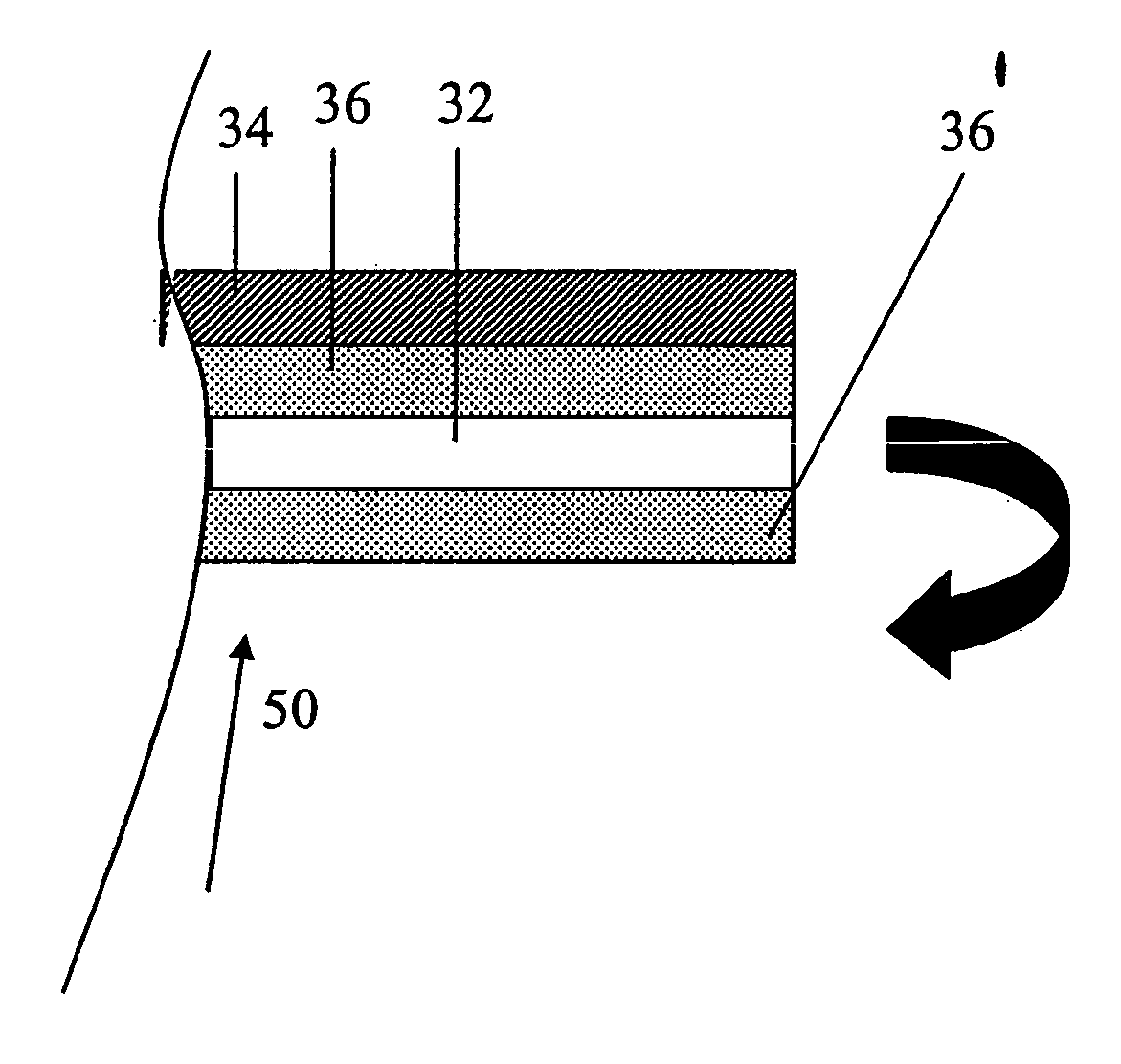 Implantable prosthesis having reinforced attachment sites