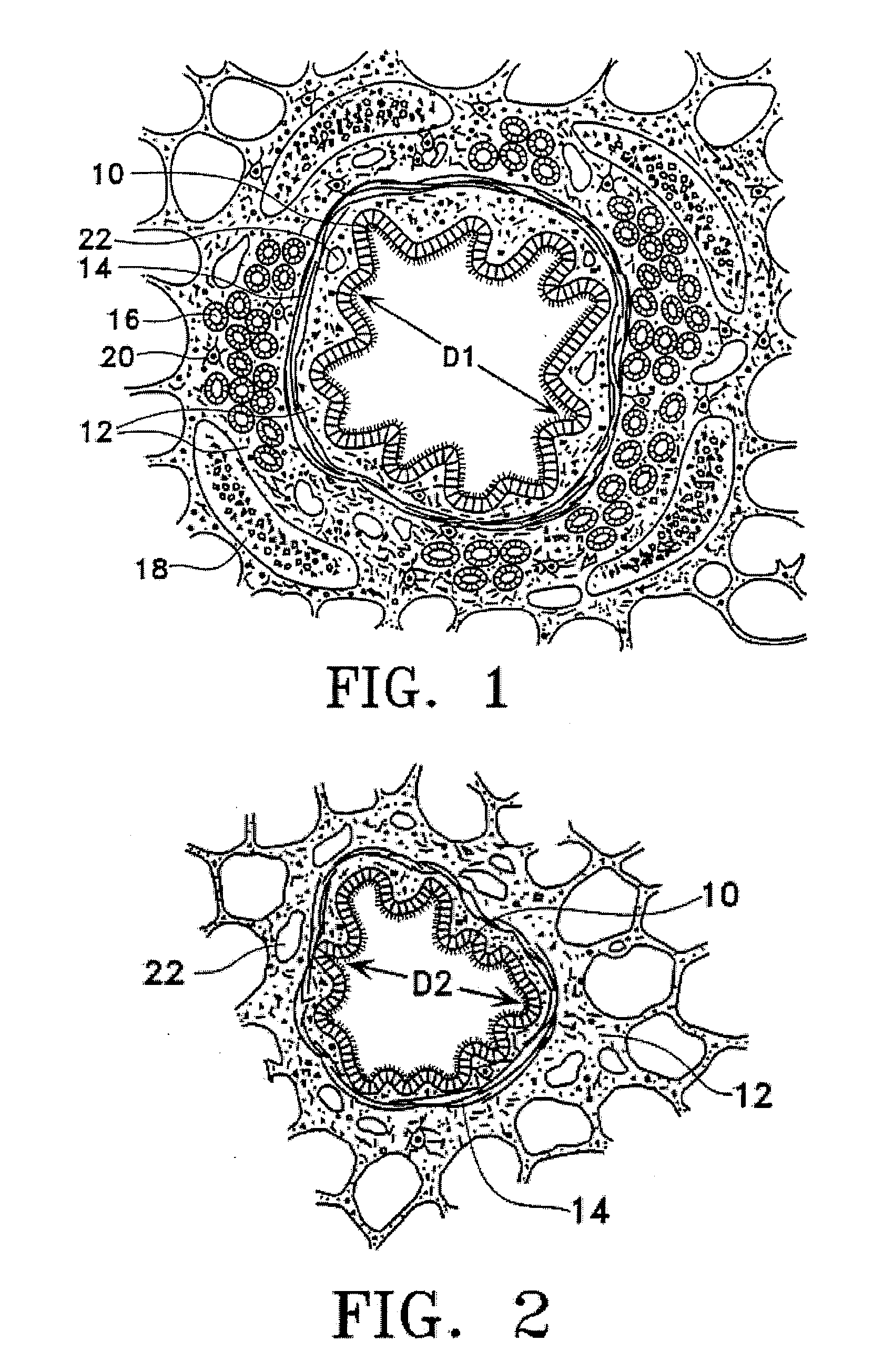 Methods of evaluating individuals having reversible obstructive pulmonary disease