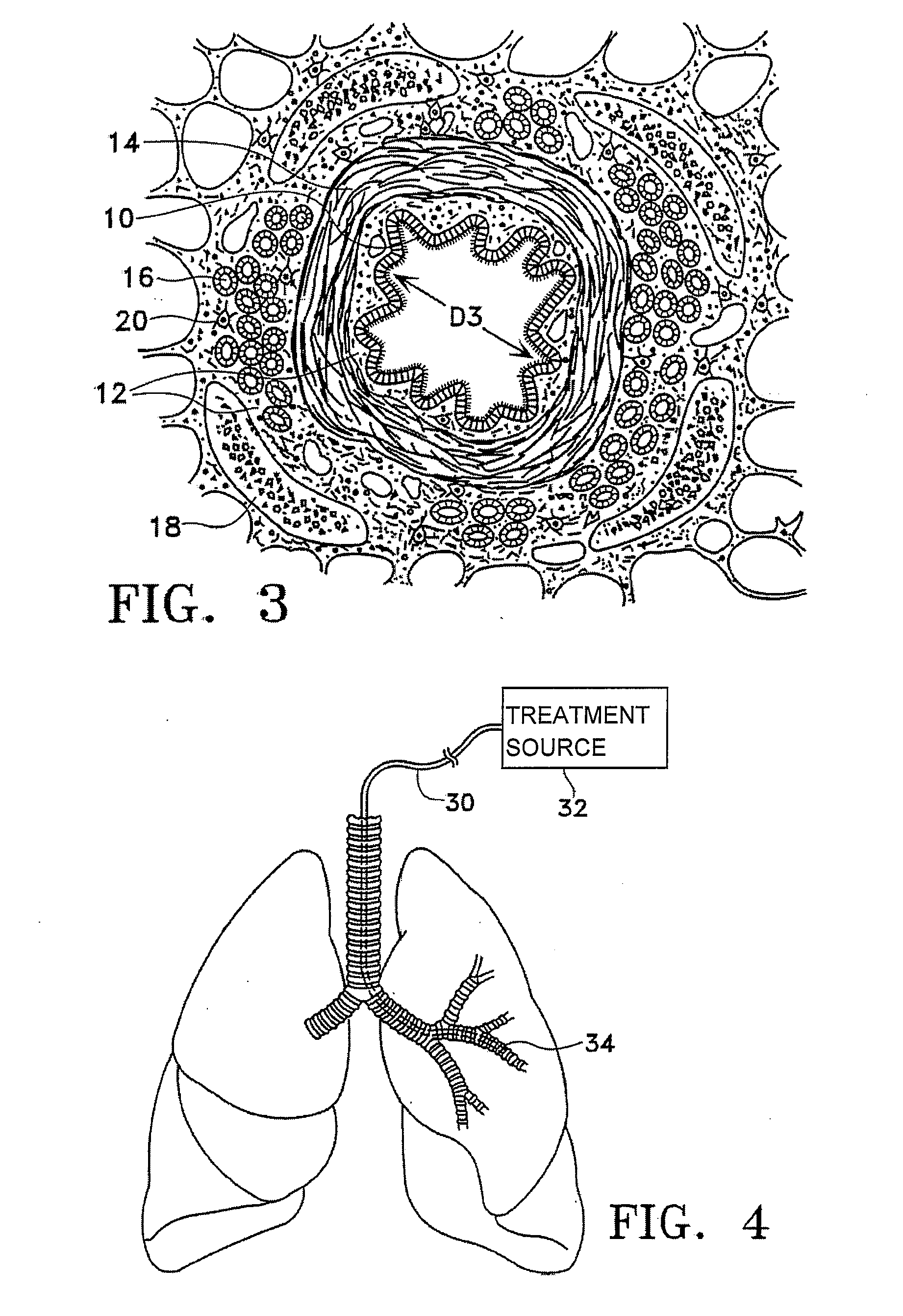 Methods of evaluating individuals having reversible obstructive pulmonary disease