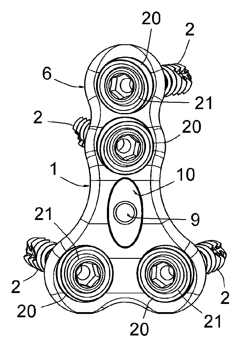 Osteosynthesis plate for lumbosacral joint