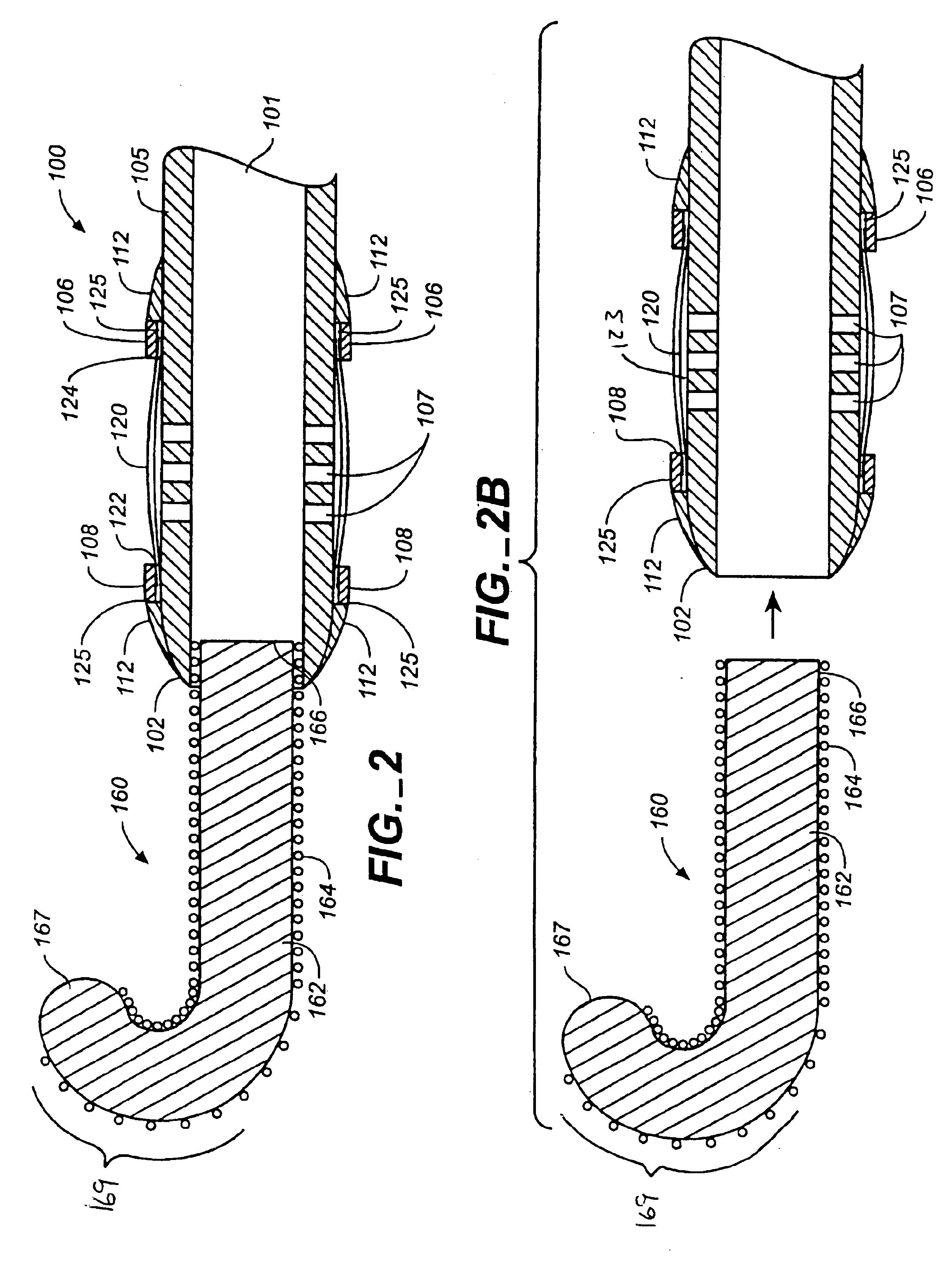 Balloon occlusion device having a proximal valve