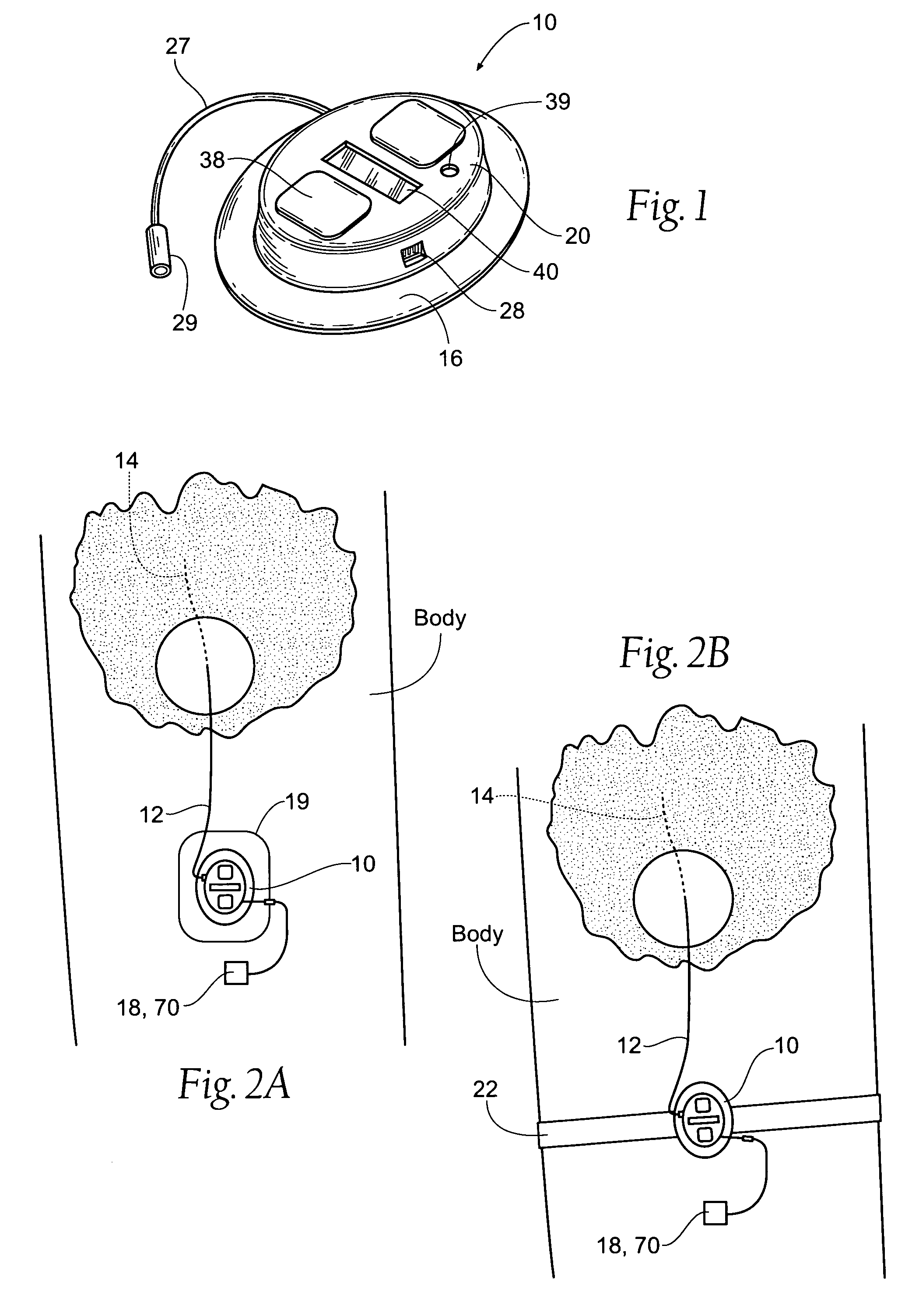 Portable assemblies, systems, and methods for providing functional or therapeutic neurostimulation