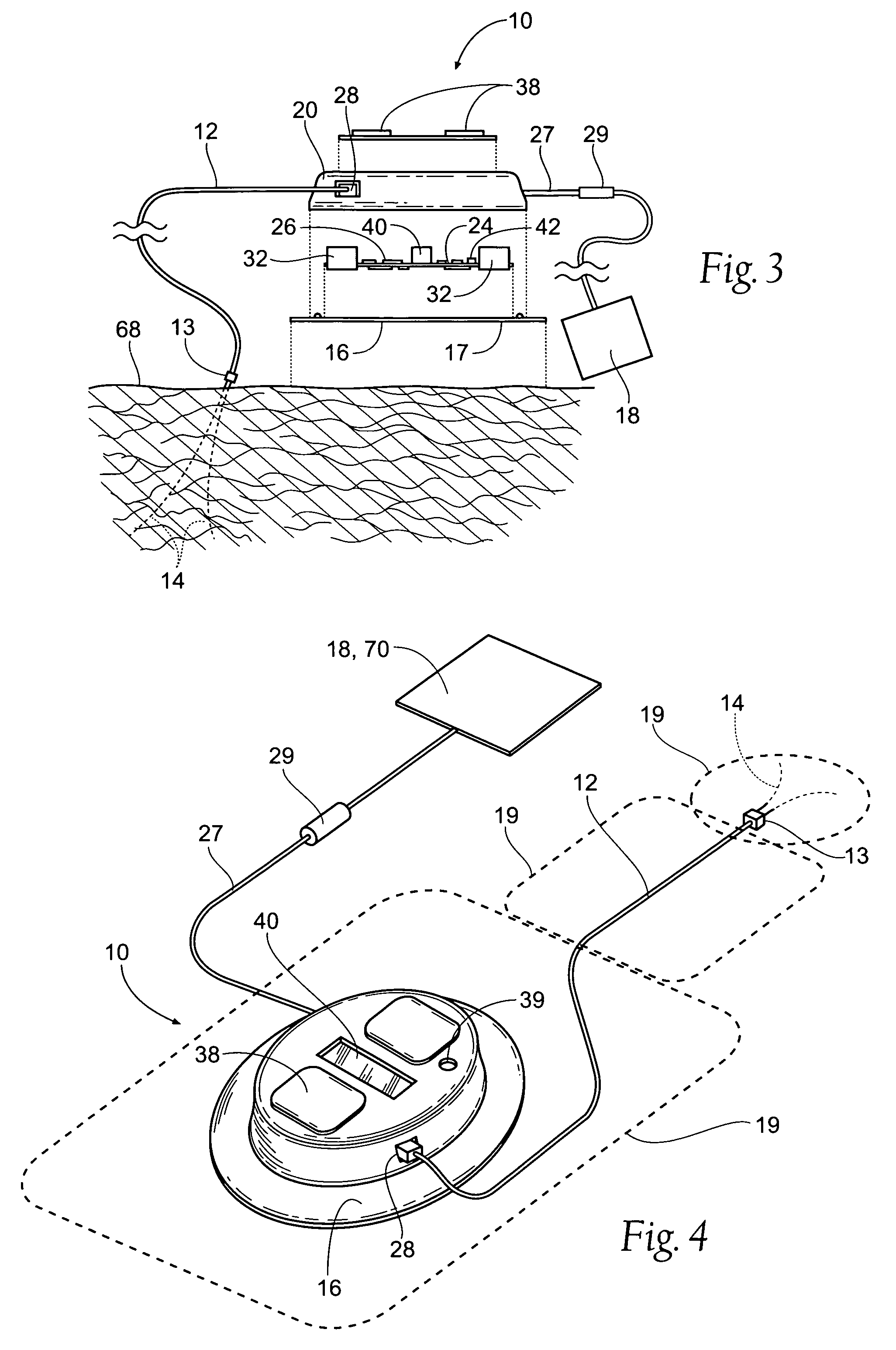 Portable assemblies, systems, and methods for providing functional or therapeutic neurostimulation