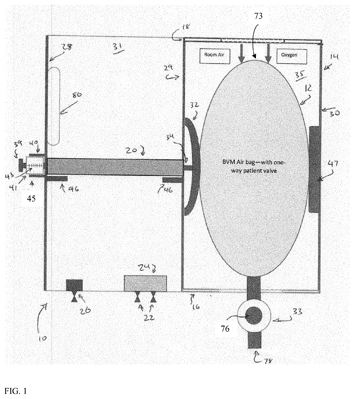 Emergency respiratory ventilator