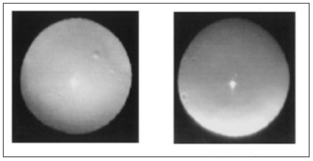 A fast measurement method for the longitudinal distance of human eye sight