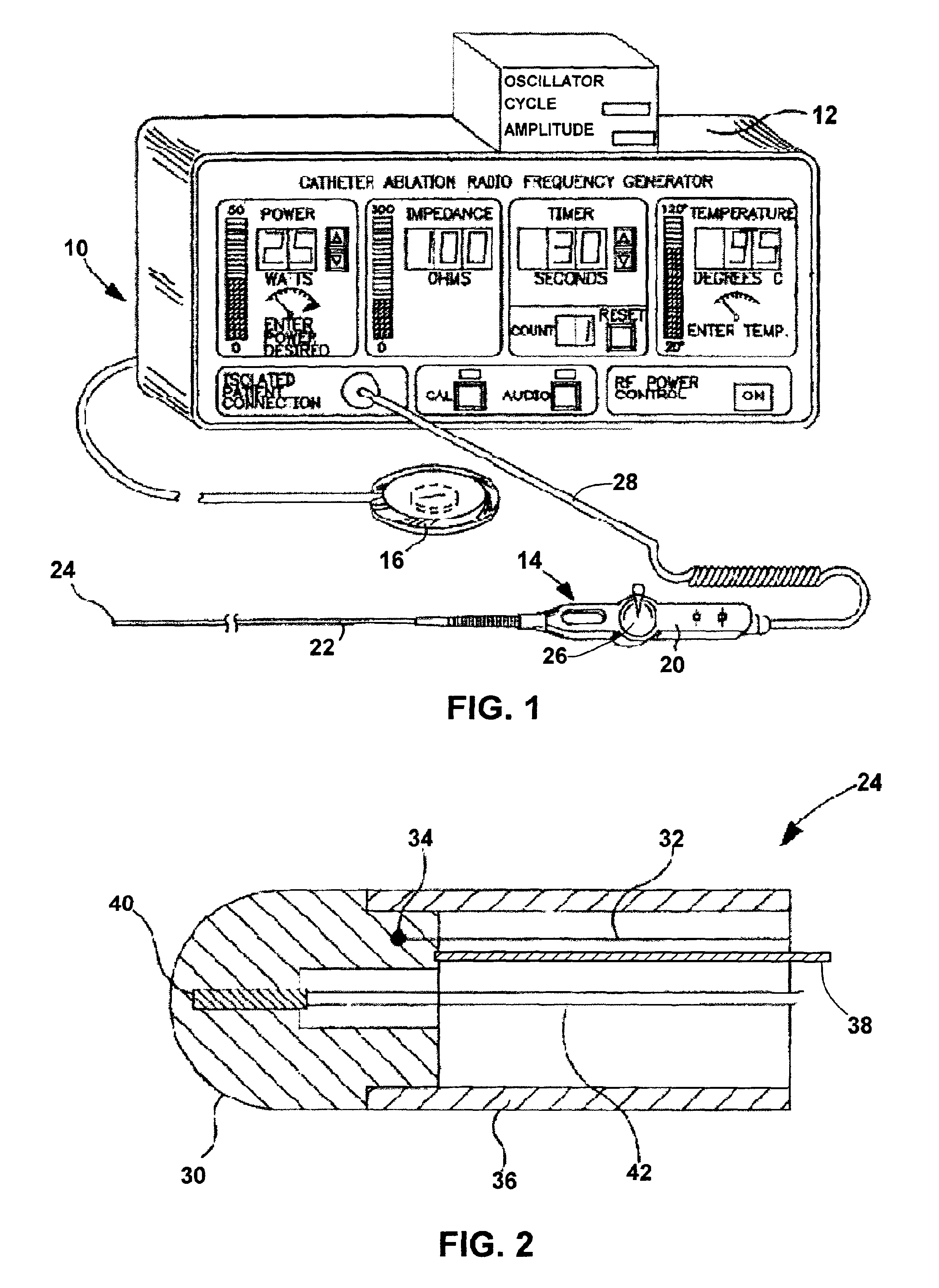 Detecting coagulum formation