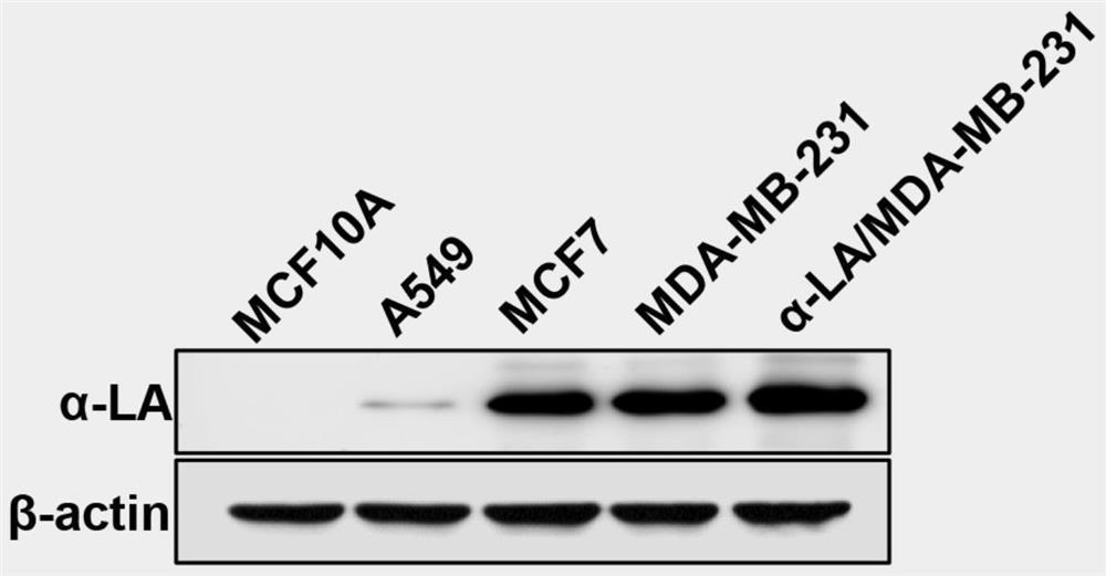 Engineered exosome in-situ nano vaccine as well as preparation method and application thereof