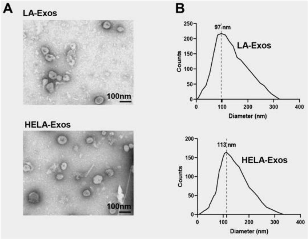 Engineered exosome in-situ nano vaccine as well as preparation method and application thereof