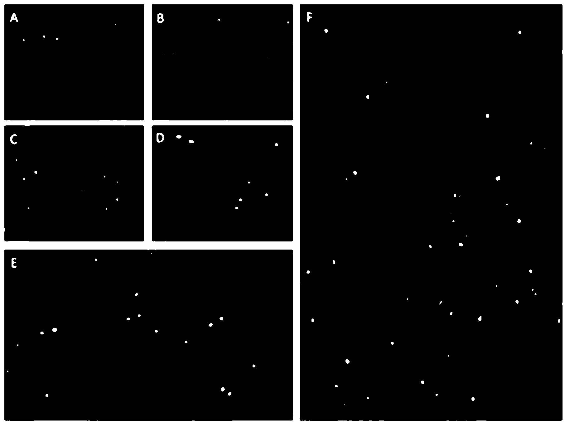 Florescent real-time quantitative PCR (Polymerase Chain Reaction) kit for detecting amplification of TERC (Telomerase RNA (Ribonucleic Acid) Component ) gene of esophageal cancer