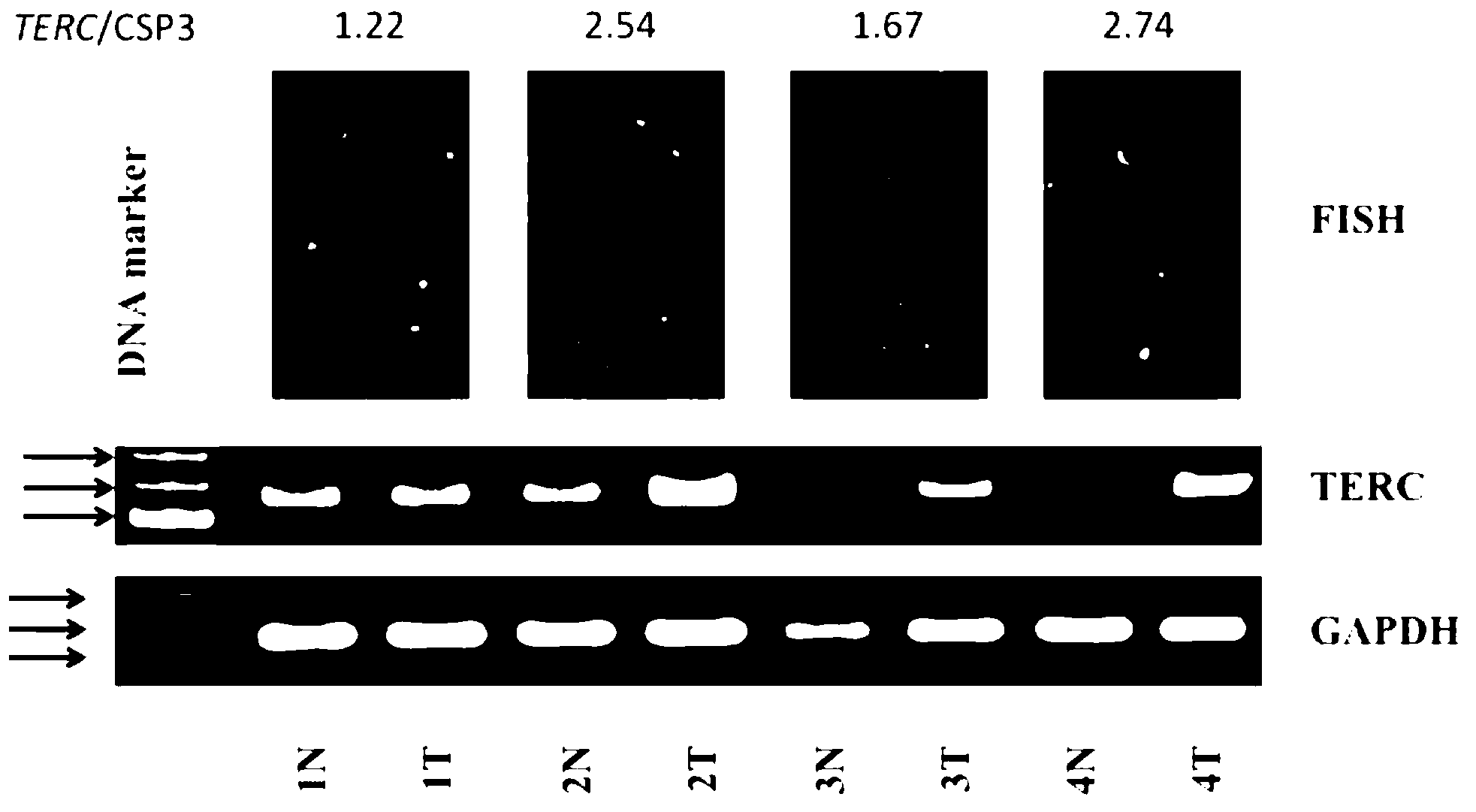 Florescent real-time quantitative PCR (Polymerase Chain Reaction) kit for detecting amplification of TERC (Telomerase RNA (Ribonucleic Acid) Component ) gene of esophageal cancer