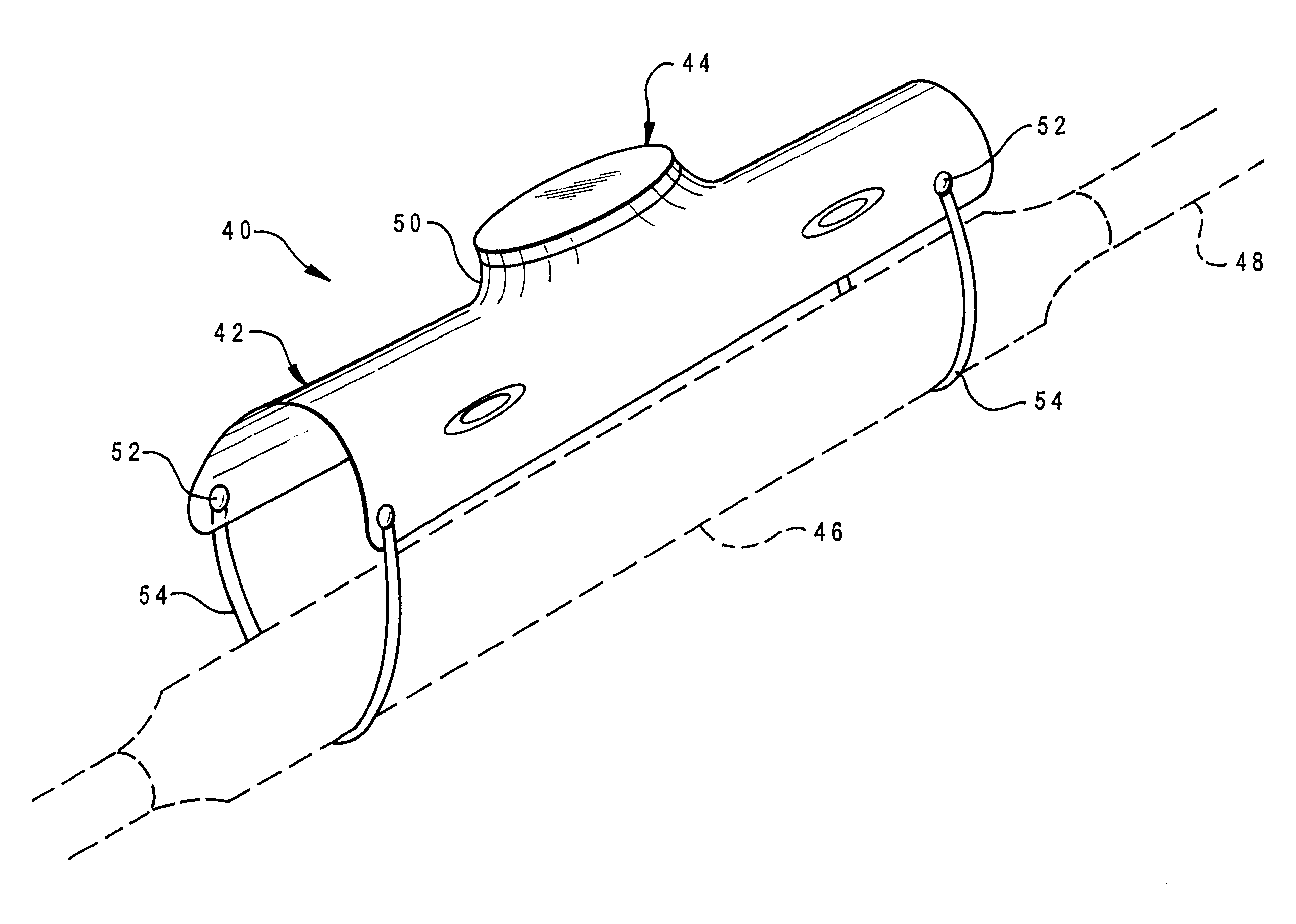 Buried closure guard with electronic marker