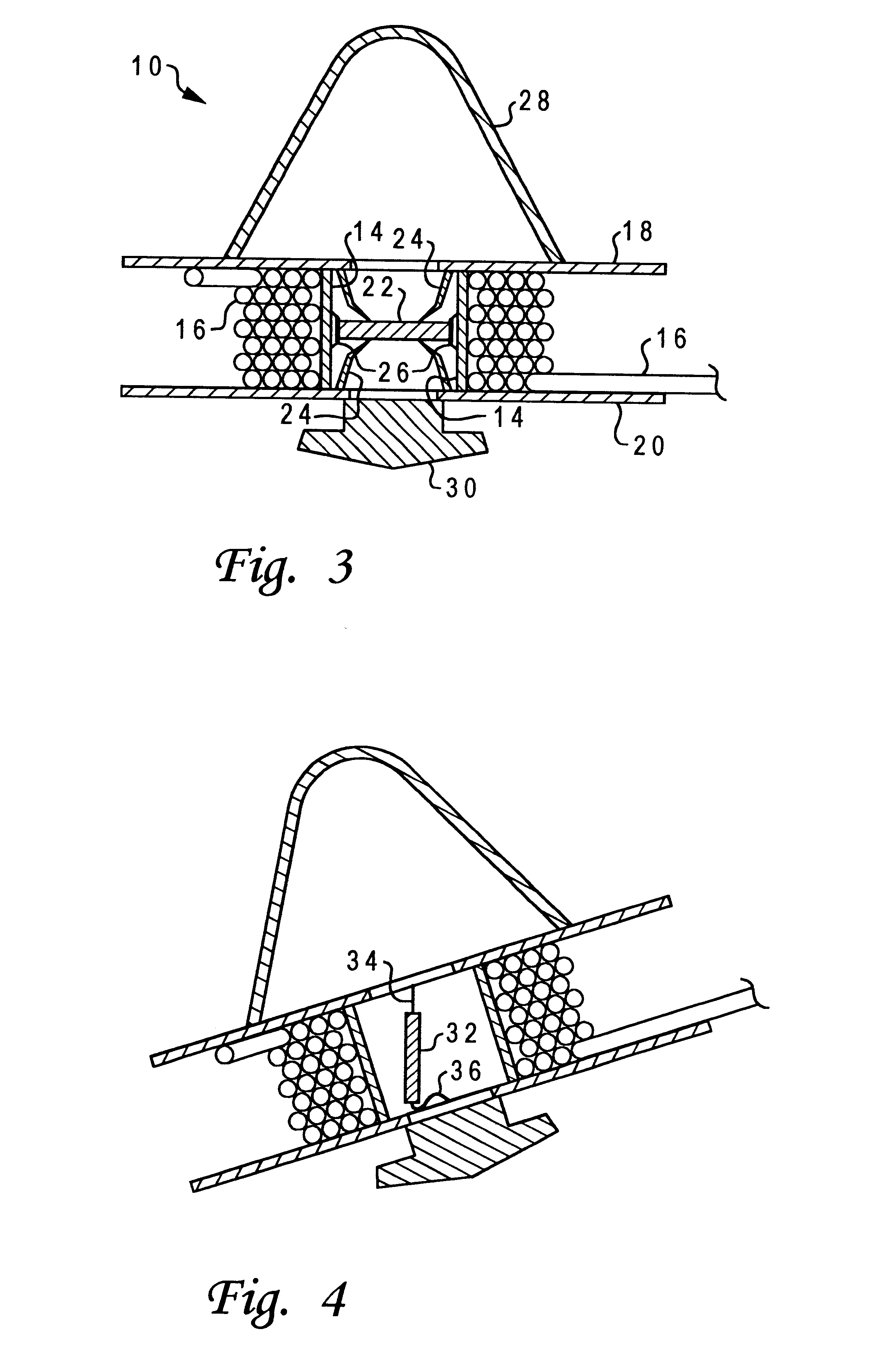 Buried closure guard with electronic marker