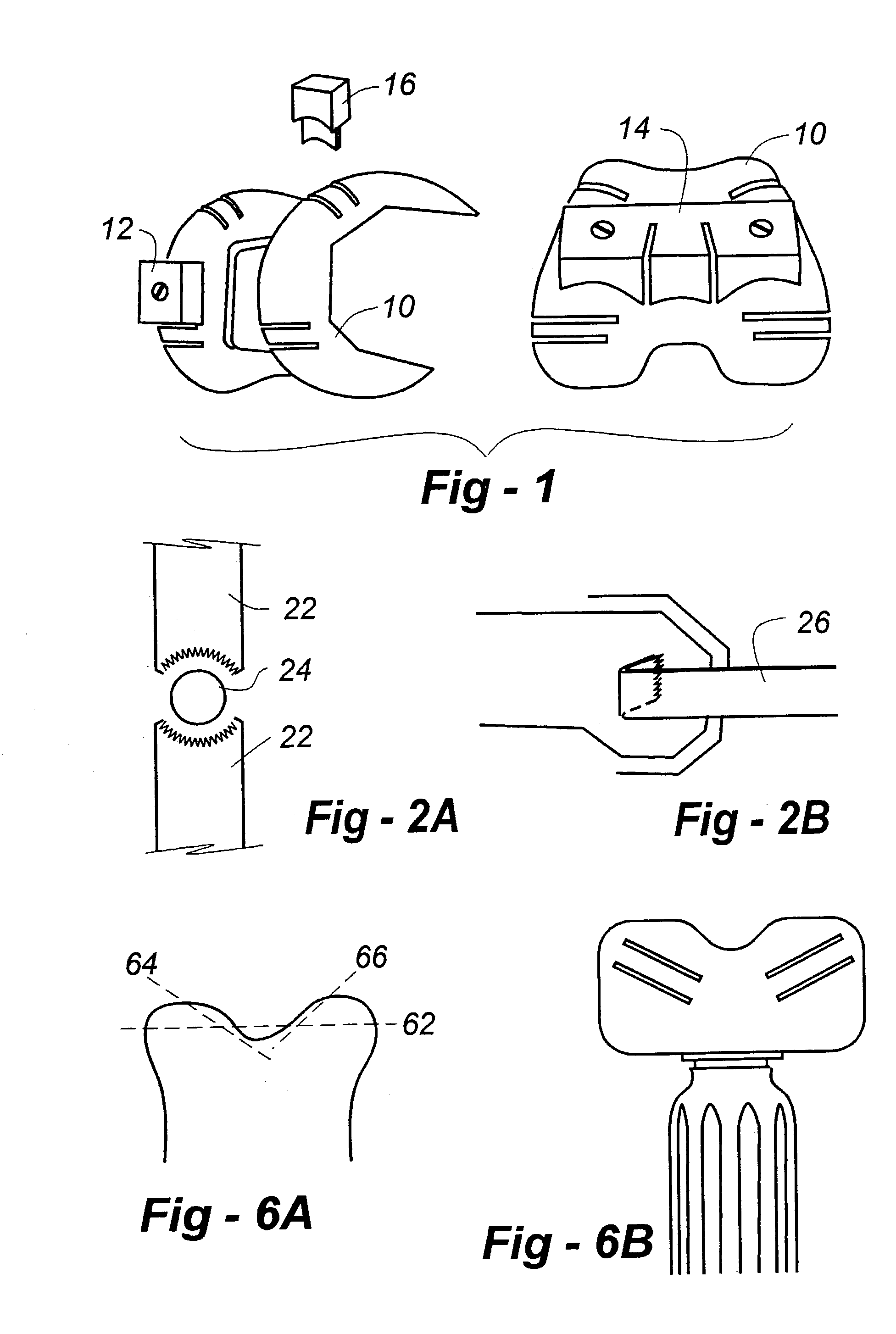 Joint replacement methods and apparatus