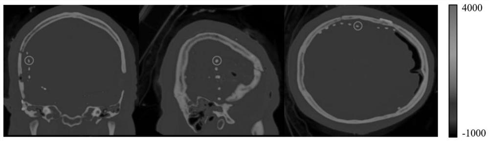 Human-computer interactive intracranial electrode positioning method and system based on three-dimensional convolution