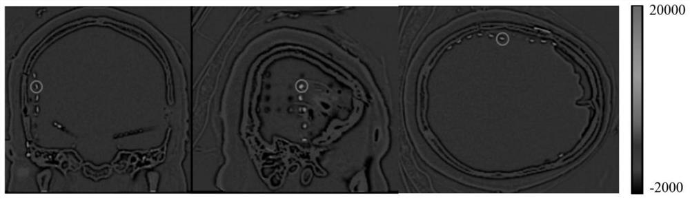 Human-computer interactive intracranial electrode positioning method and system based on three-dimensional convolution