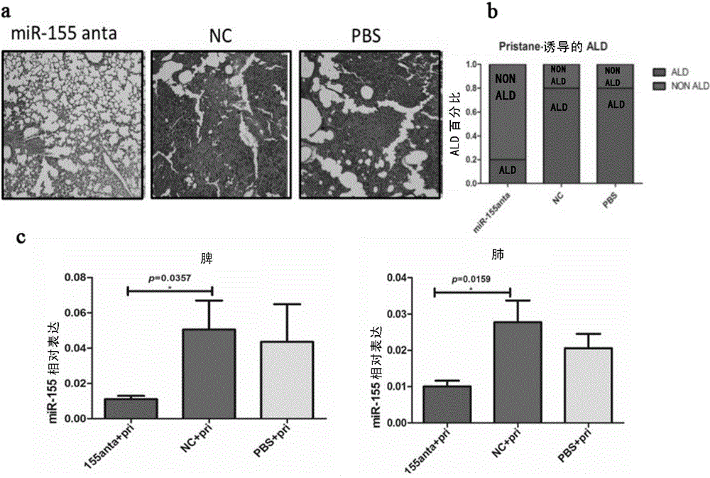 Use of miR-155 in preparation of acute lung injury prevention and treatment drugs