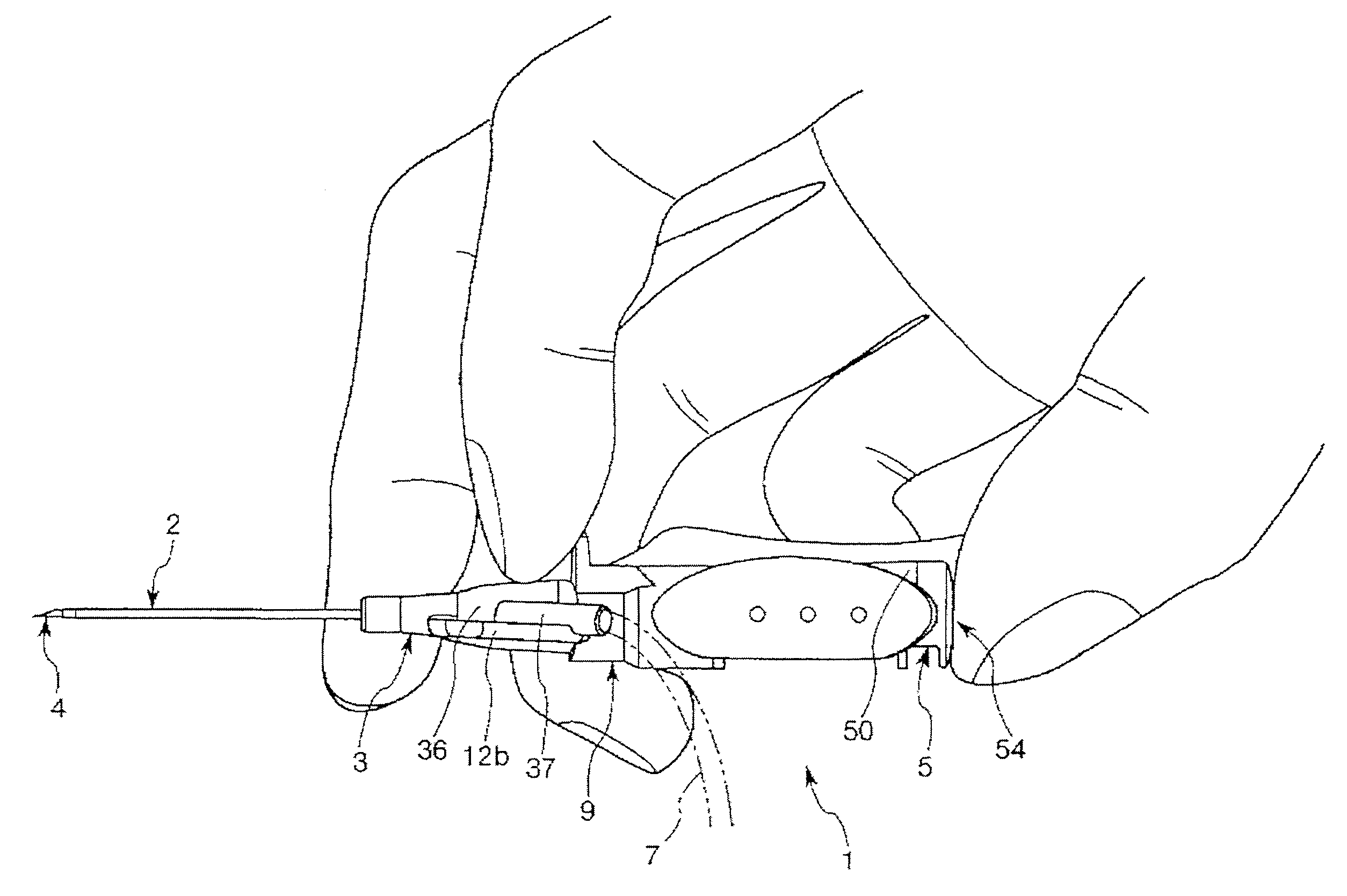 Indwelling needle assembly and method of using the same